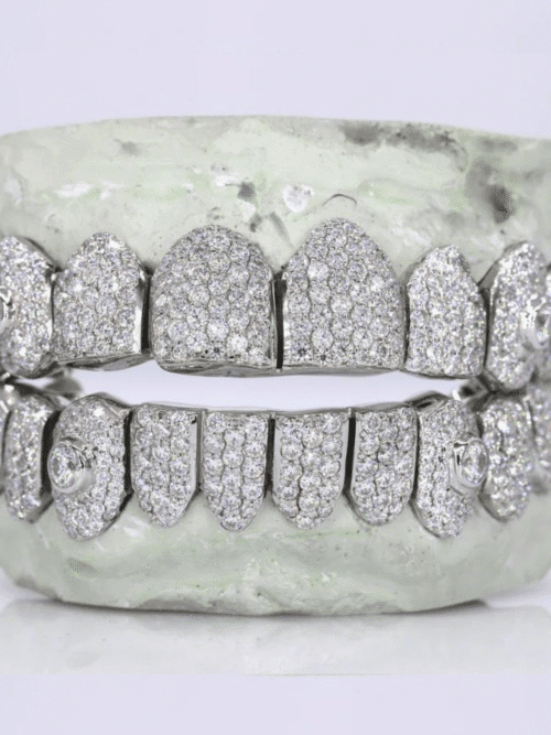 925 Silver VVS Moissanite Iced Out Teeth Grillz