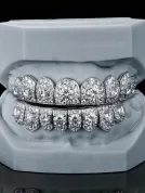 icedout teeth grillz1