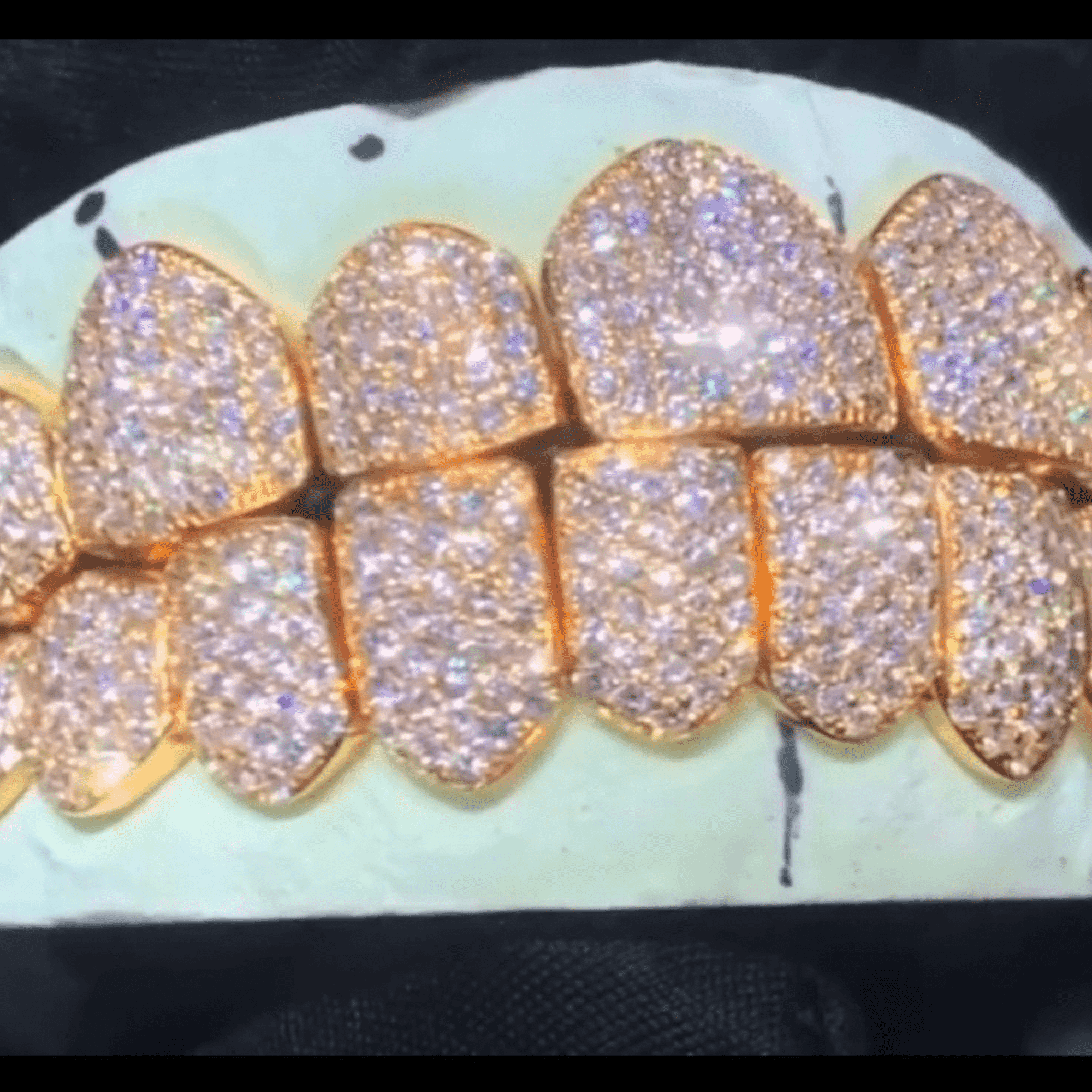 925 Sterling Silver Custom Mold Teeth Grillz – Real Silver Shine & Durability - Image 2
