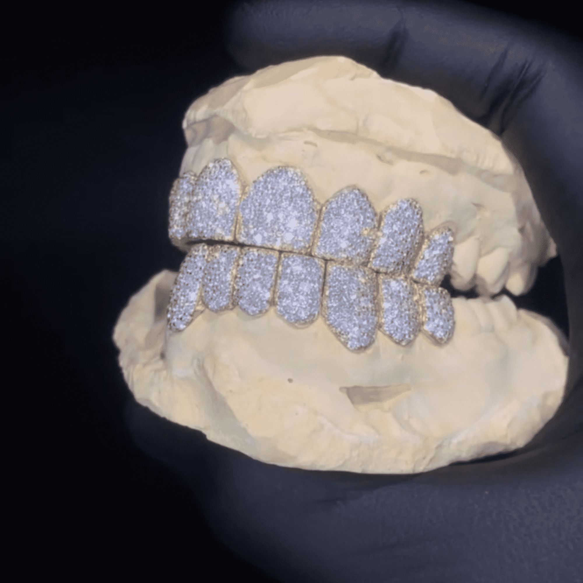 Moissanite Diamond Hip-Hop Teeth Grillz – Ultra Sparkle Realistic Shine - Image 2