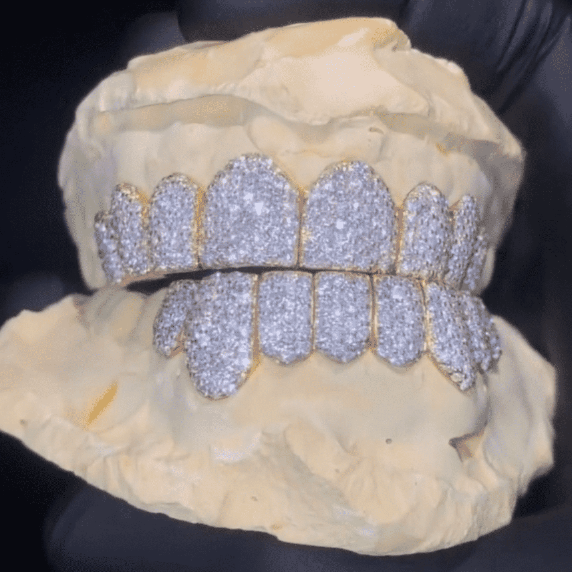 Moissanite Diamond Hip-Hop Teeth Grillz – Ultra Sparkle Realistic Shine - Image 3