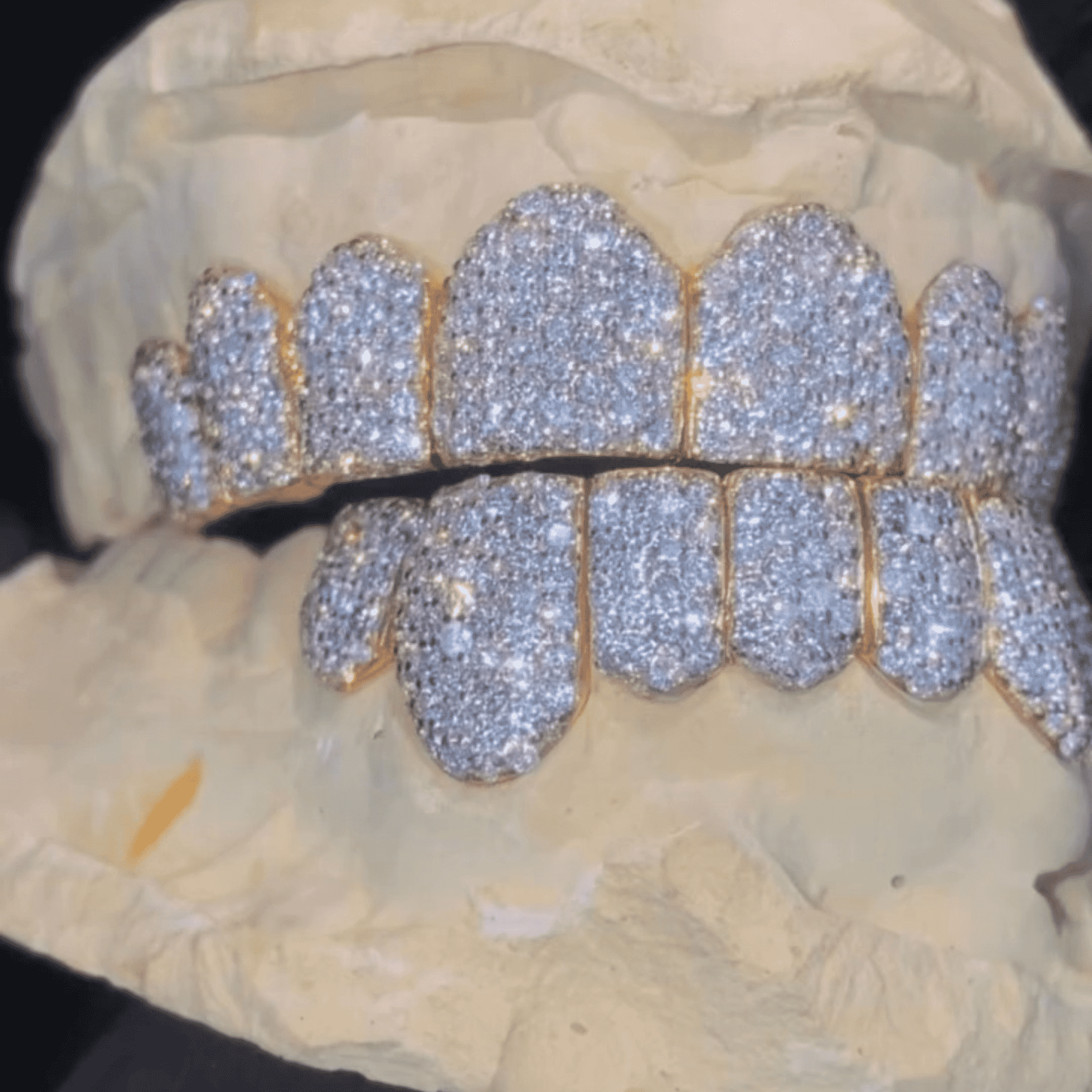 Moissanite Diamond Hip-Hop Teeth Grillz – Ultra Sparkle Realistic Shine - Image 4