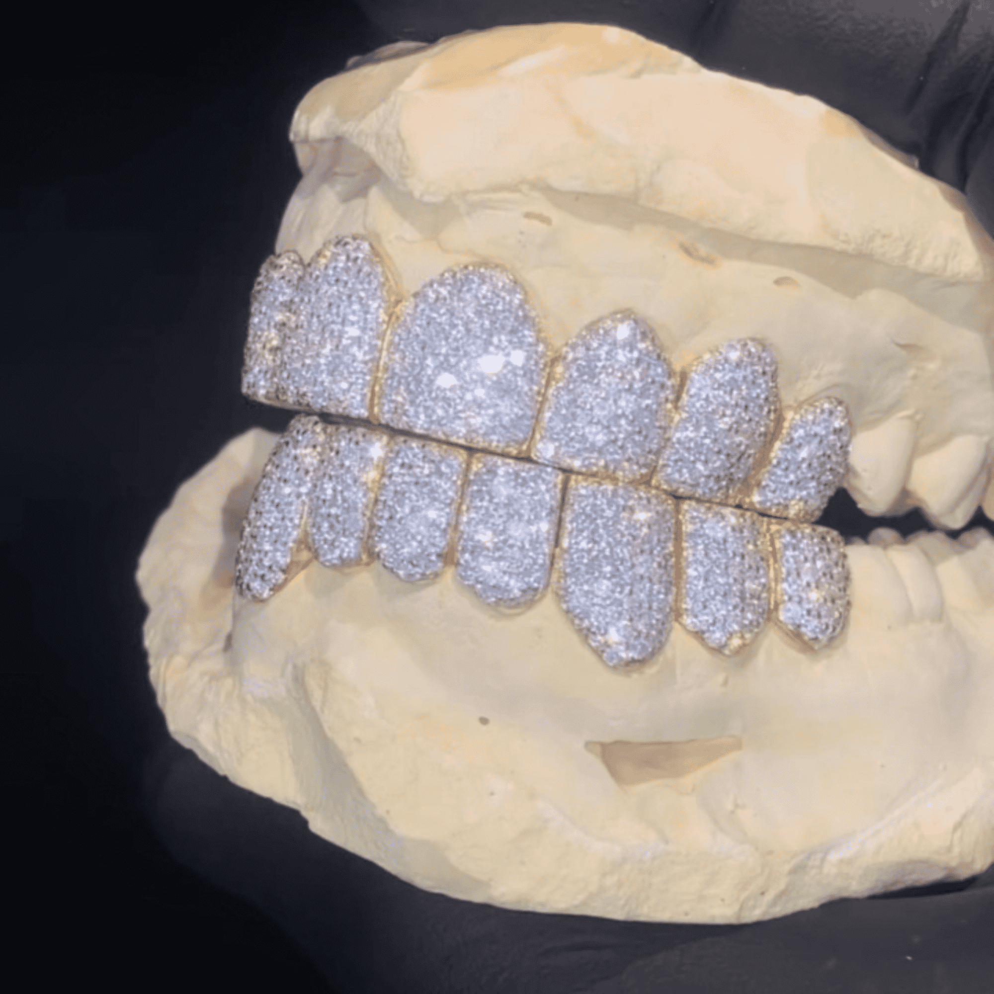 Moissanite Diamond Hip-Hop Teeth Grillz – Ultra Sparkle Realistic Shine - Image 5