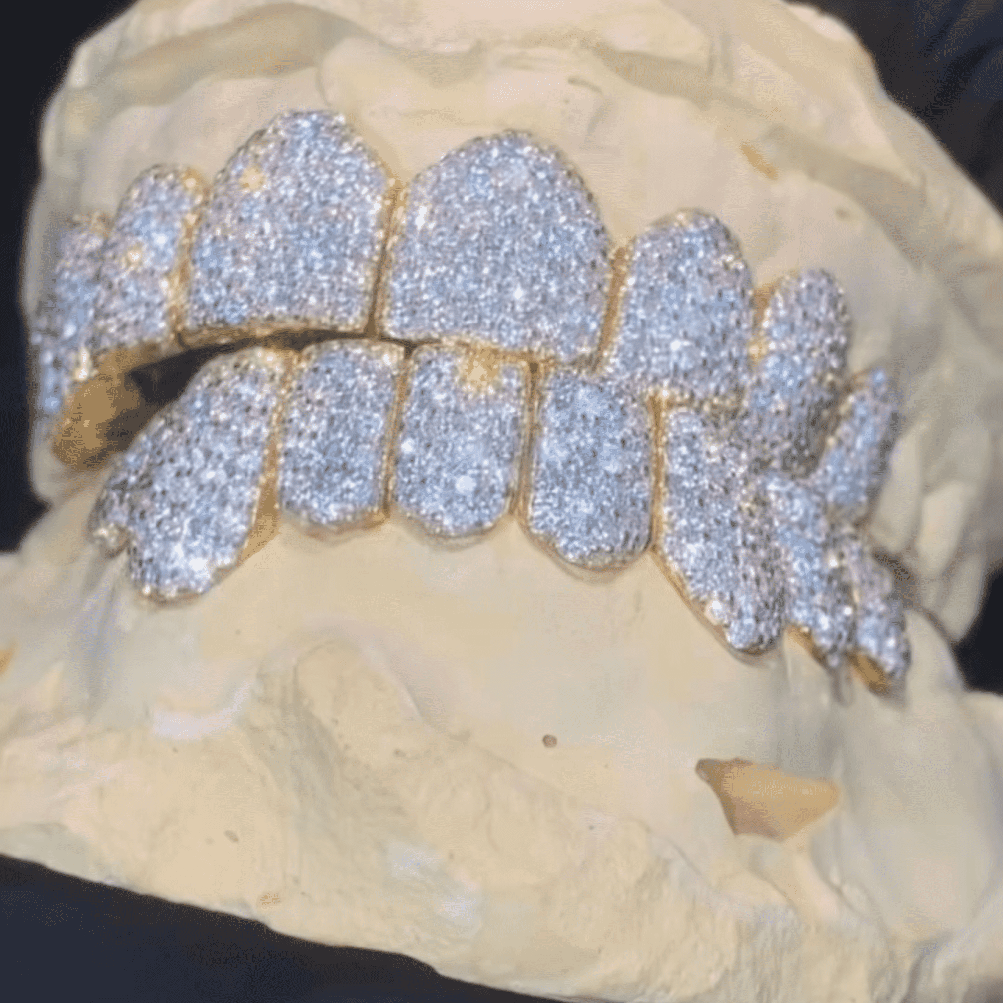 Moissanite Diamond Hip-Hop Teeth Grillz – Ultra Sparkle Realistic Shine - Image 6