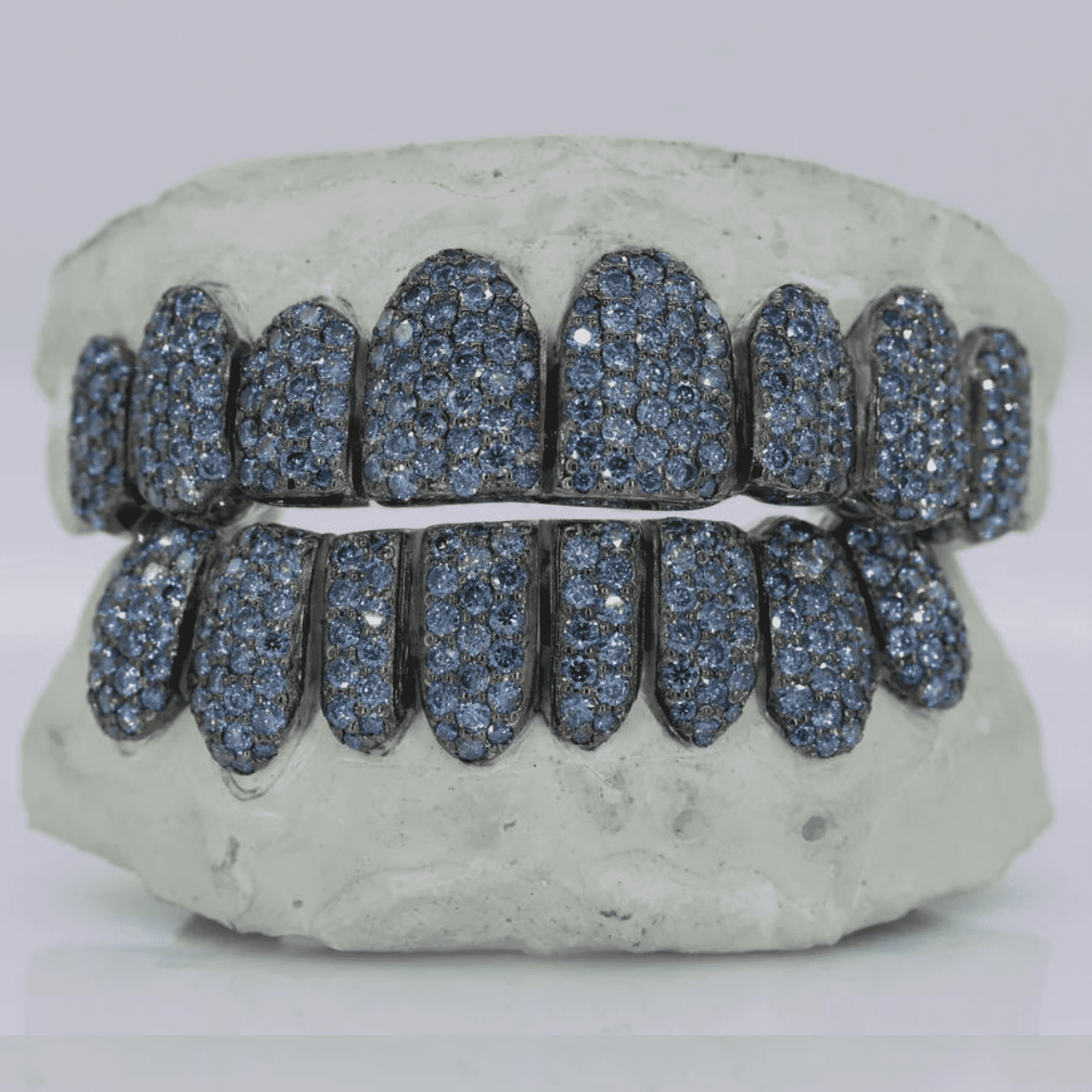18K Gold Heavy Shine Teeth Grillz – Rich Color & Stylish Look - Image 2