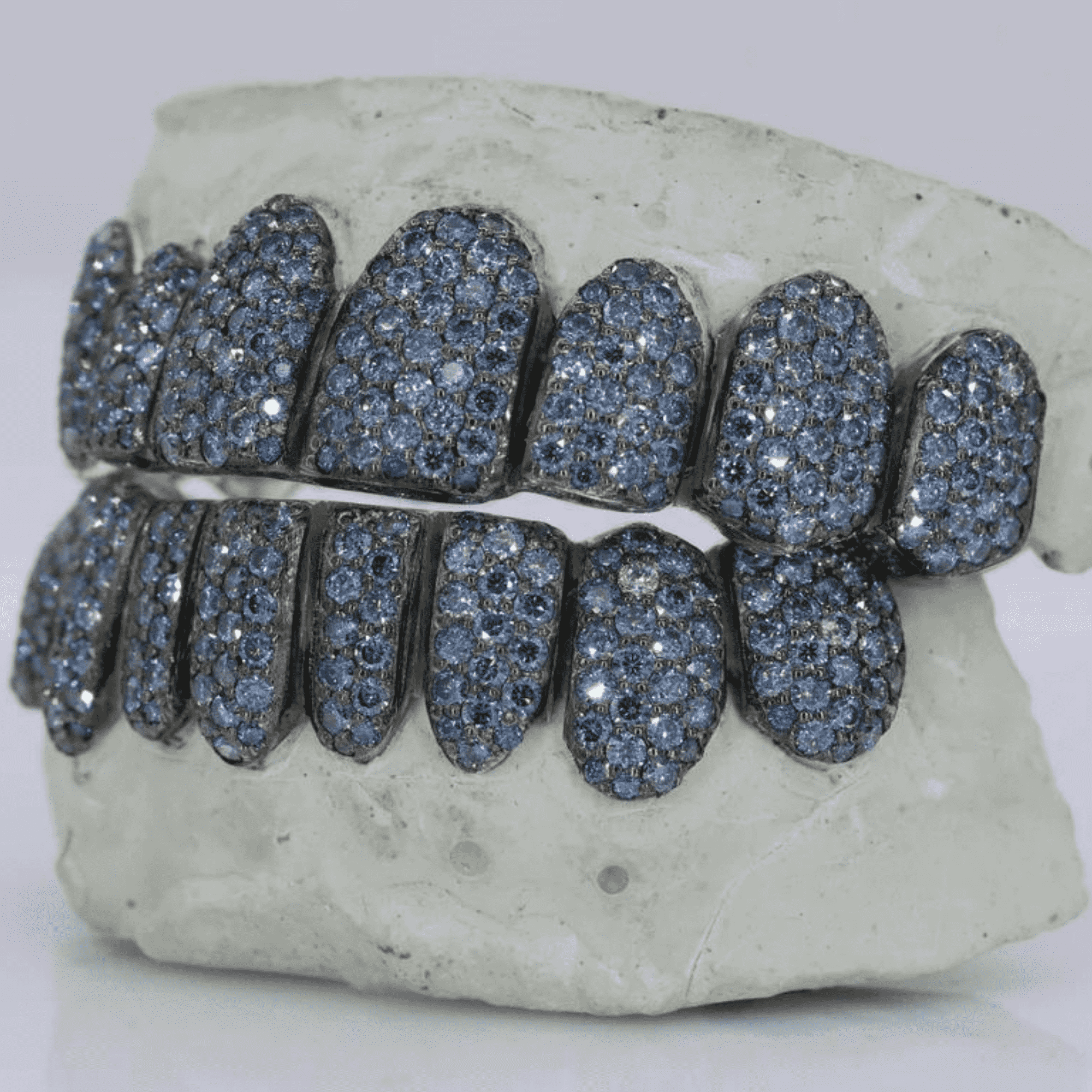 18K Gold Heavy Shine Teeth Grillz – Rich Color & Stylish Look - Image 3