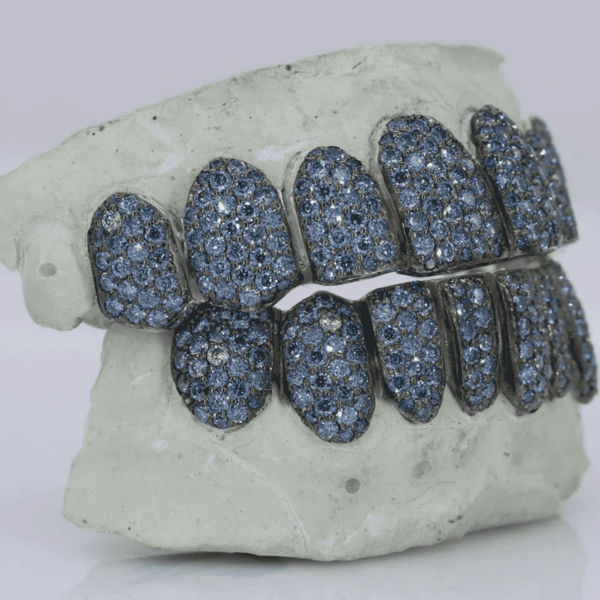 18K Gold Heavy Shine Teeth Grillz – Rich Color & Stylish Look - Image 4