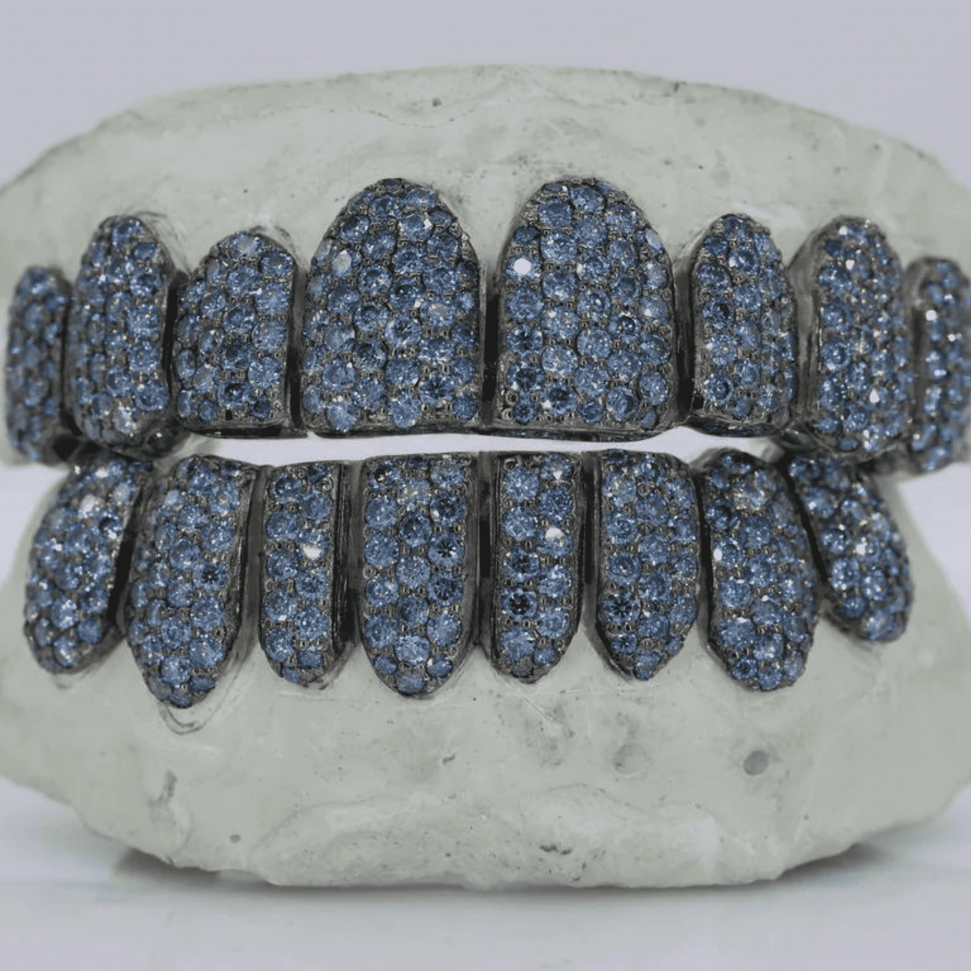 18K Gold Heavy Shine Teeth Grillz – Rich Color & Stylish Look - Image 5