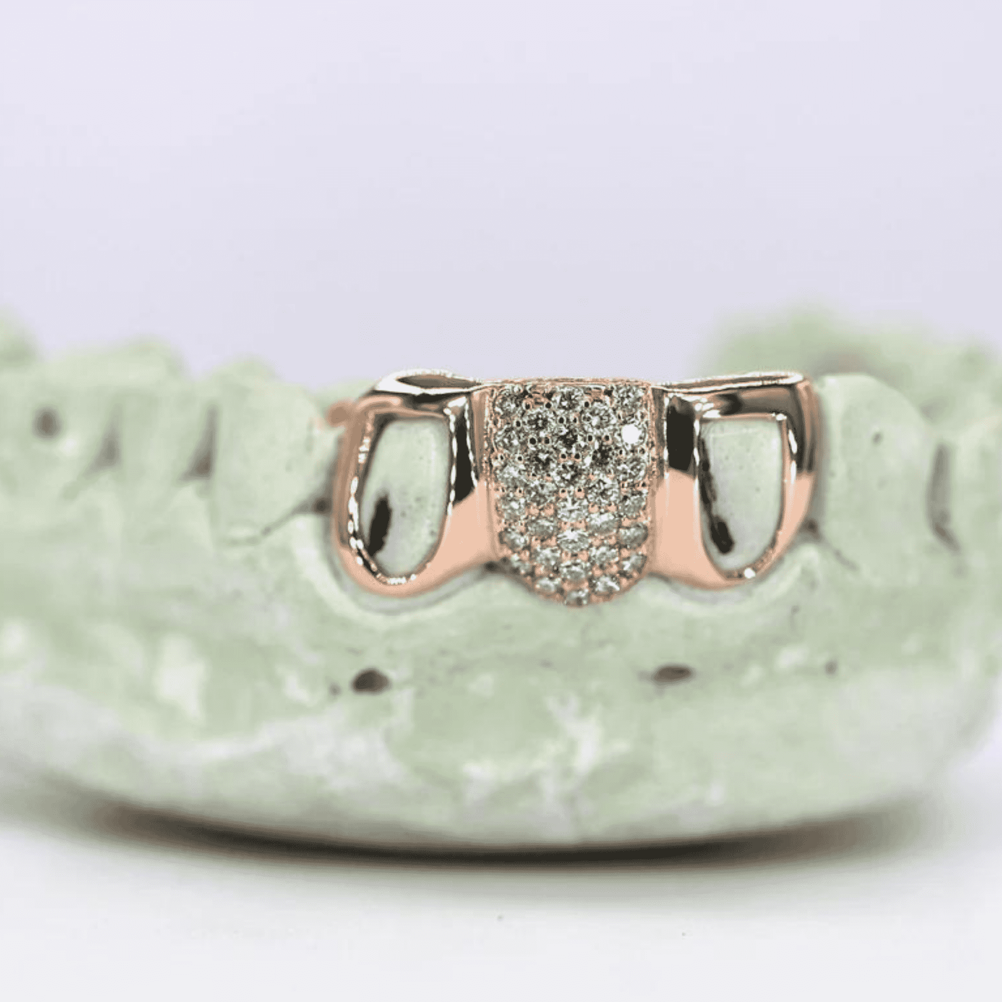 Full Moissanite Diamond Shine Teeth Grillz – Ultra-Premium Hip-Hop Jewelry - Image 2