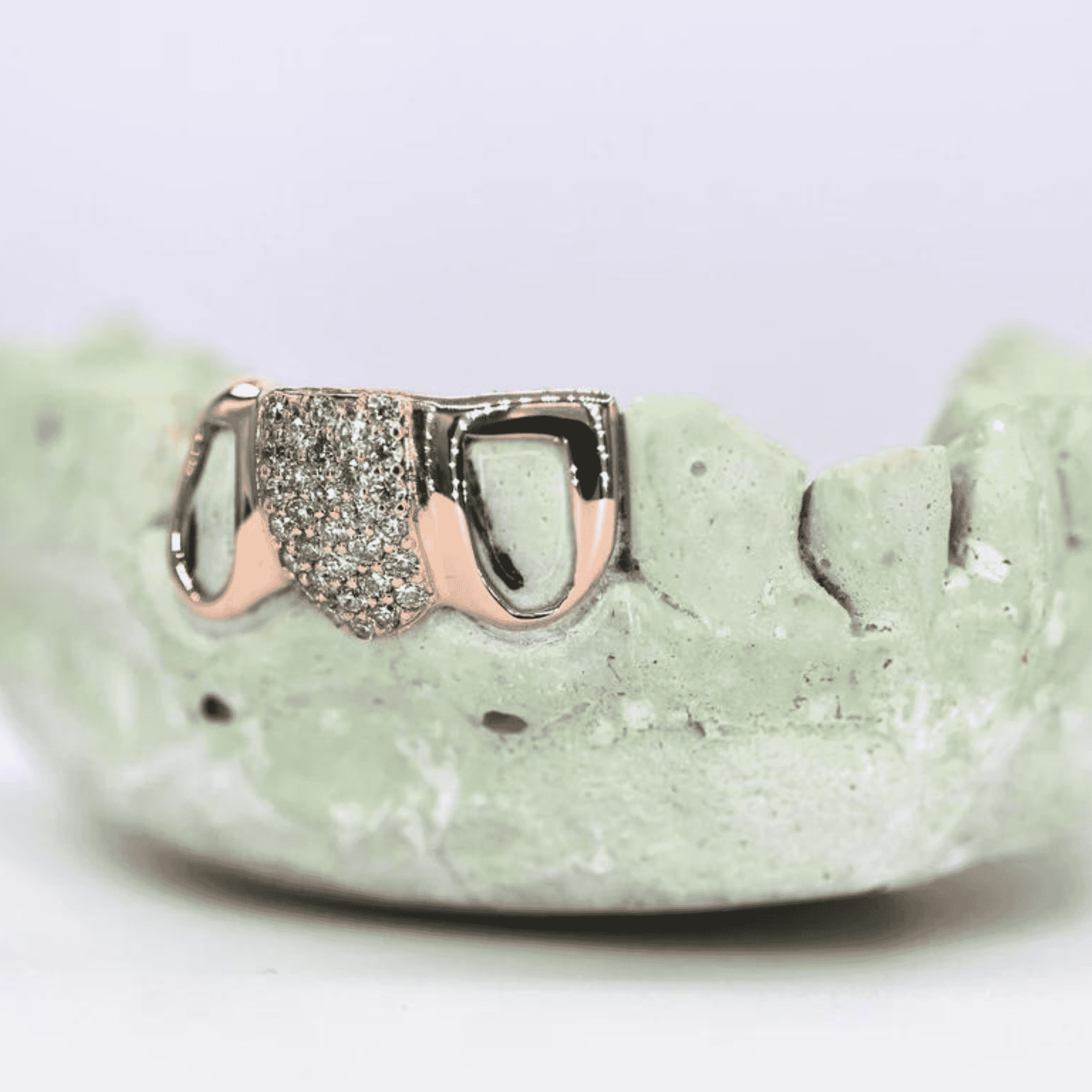 Full Moissanite Diamond Shine Teeth Grillz – Ultra-Premium Hip-Hop Jewelry - Image 3
