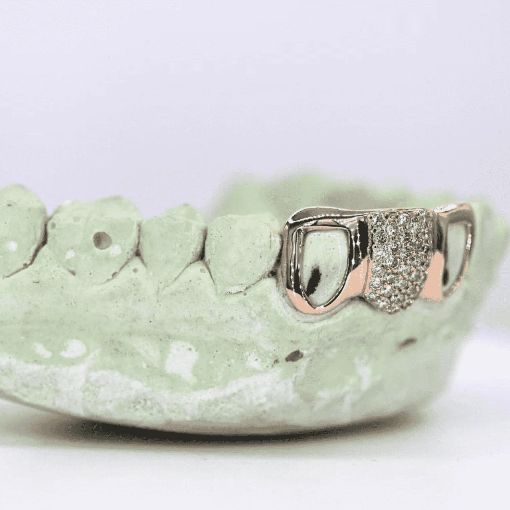 Full Moissanite Diamond Shine Teeth Grillz – Ultra-Premium Hip-Hop Jewelry - Image 4