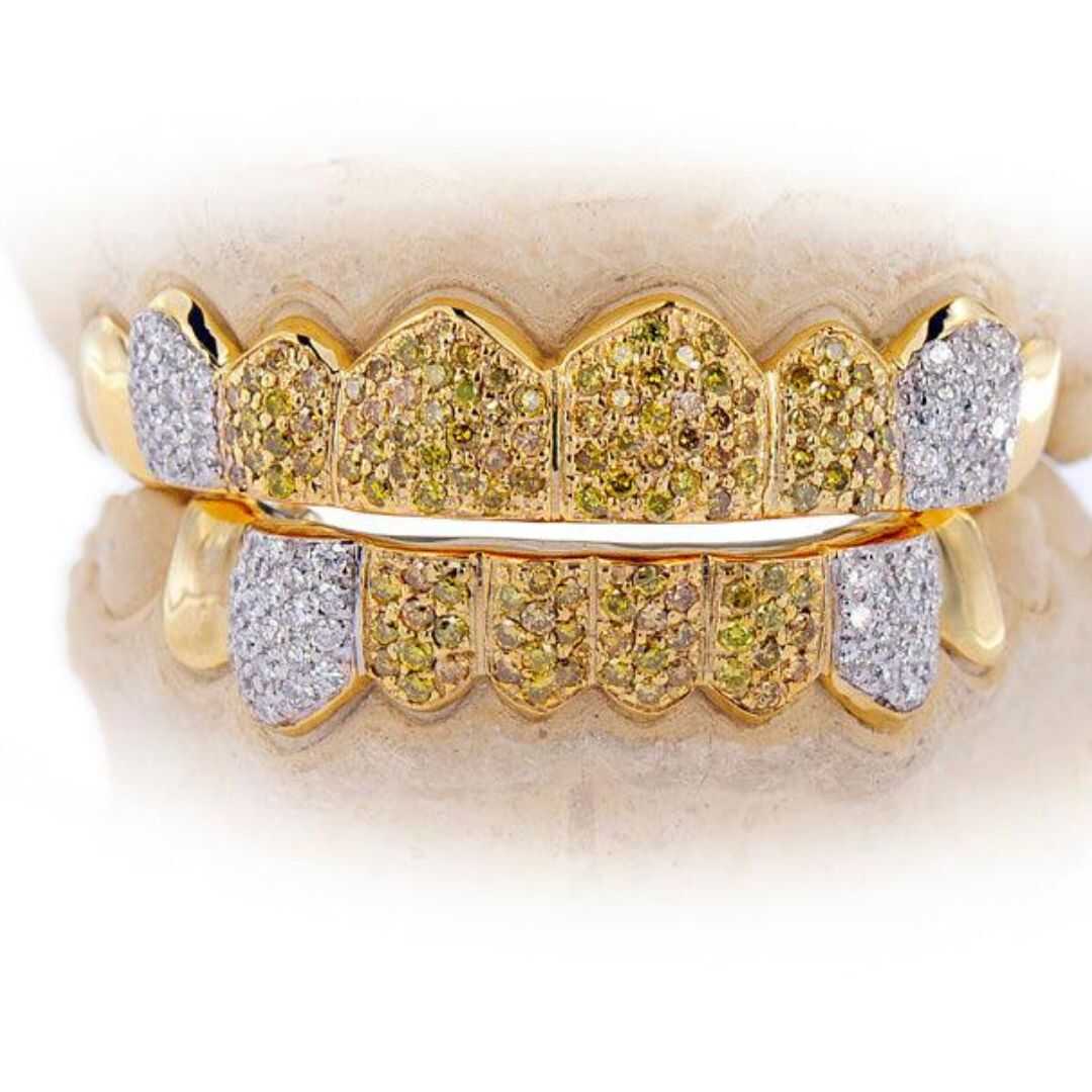 Diamond Grillz