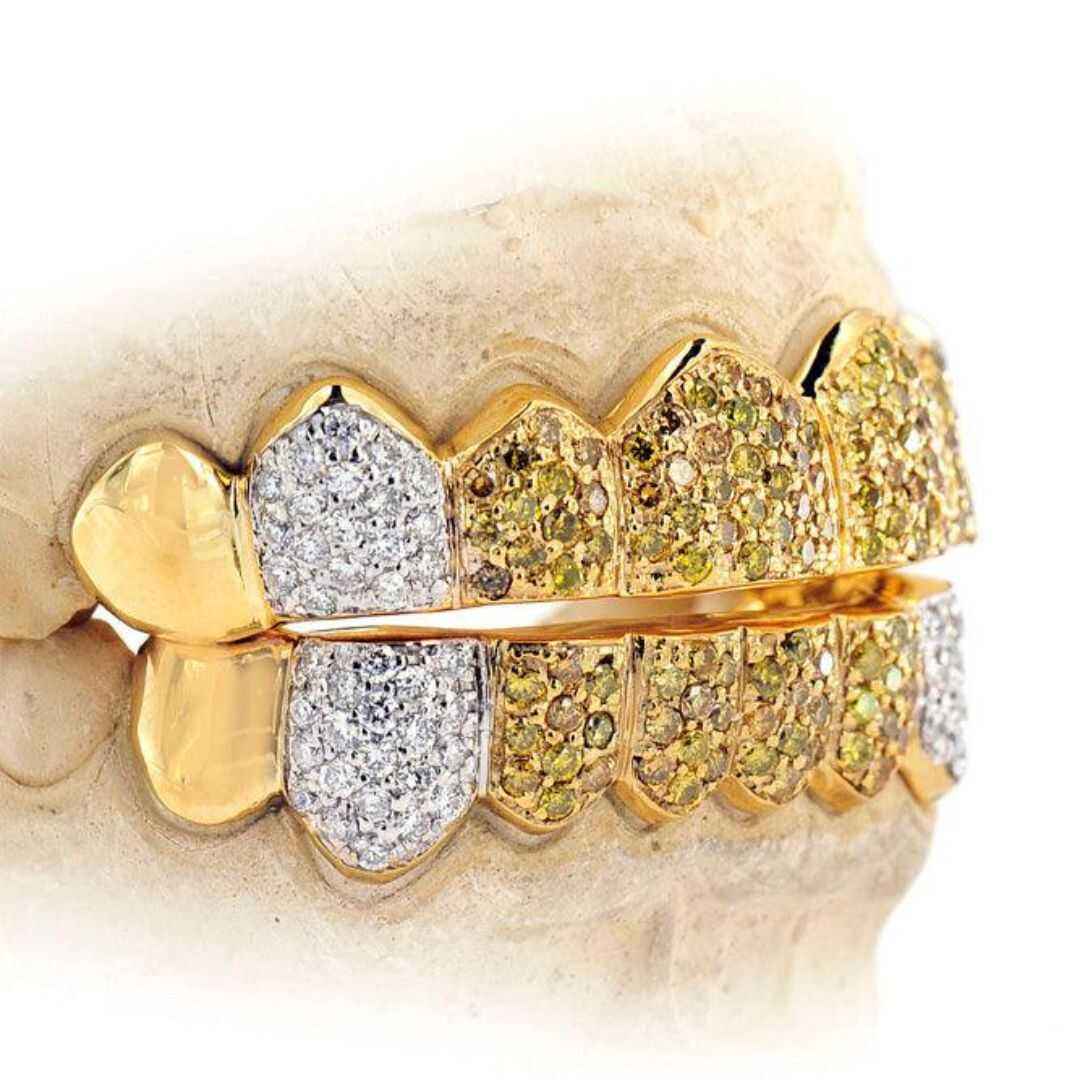 Diamond Grillz