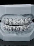 icedout teeth grillz1