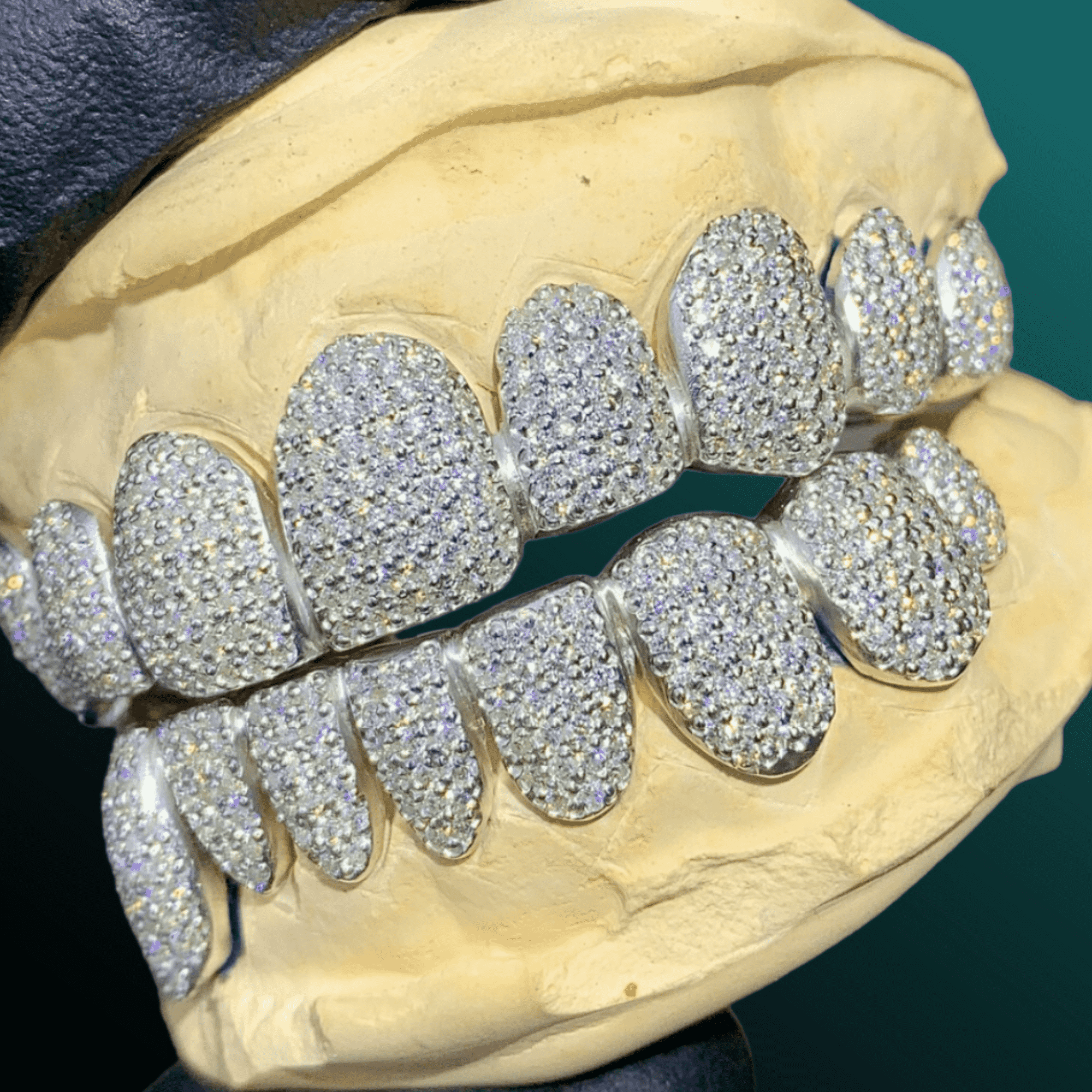 Gold Drip Diamond Style Teeth Grillz – Bold Hip-Hop Style Accessory 2 Gold Drip Diamond Style Teeth Grillz – Bold Hip-Hop Style Accessory - Image 2
