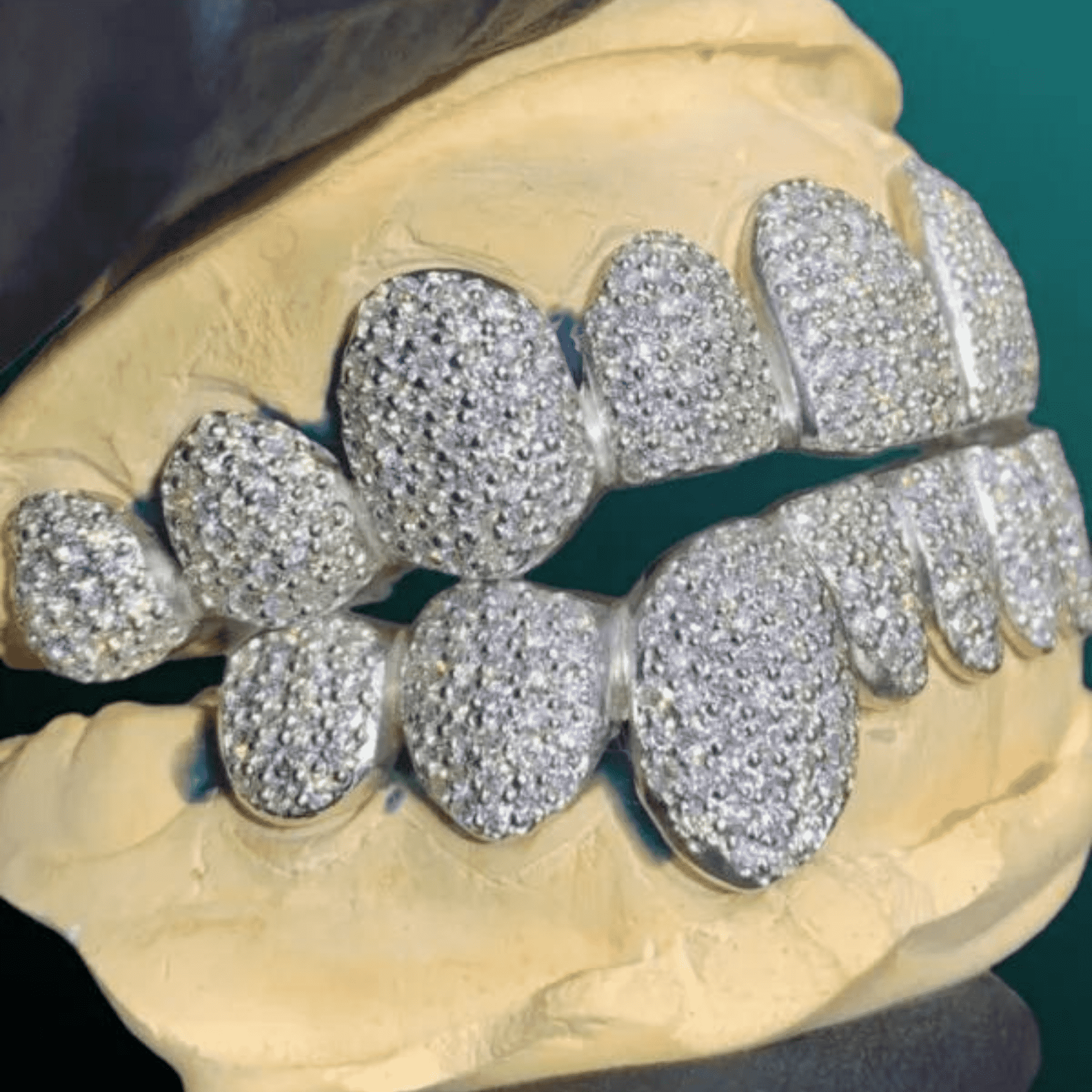 Gold Drip Diamond Style Teeth Grillz – Bold Hip-Hop Style Accessory 3 Gold Drip Diamond Style Teeth Grillz – Bold Hip-Hop Style Accessory - Image 3