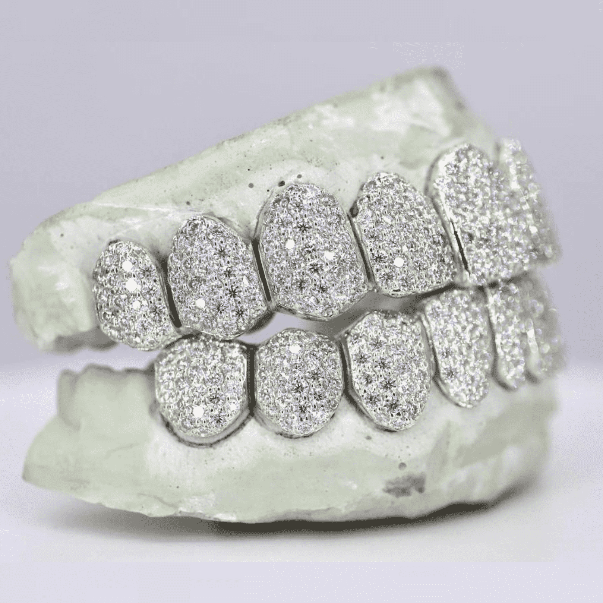Sterling Silver Custom Fit Teeth Grillz – Clean Look with Silver Luster 4 Sterling Silver Custom Fit Teeth Grillz – Clean Look with Silver Luster - Image 4