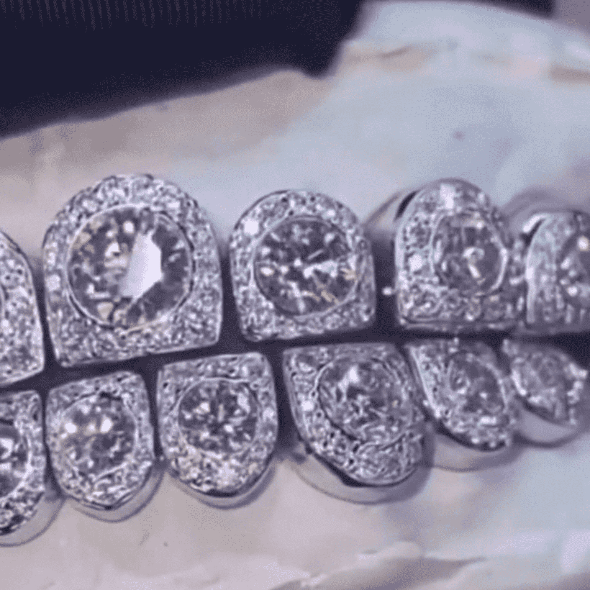 Iced Out Diamond Teeth Grillz – Full Stone Set High Flash Grillz 2 Iced Out Diamond Teeth Grillz – Full Stone Set High Flash Grillz - Image 2