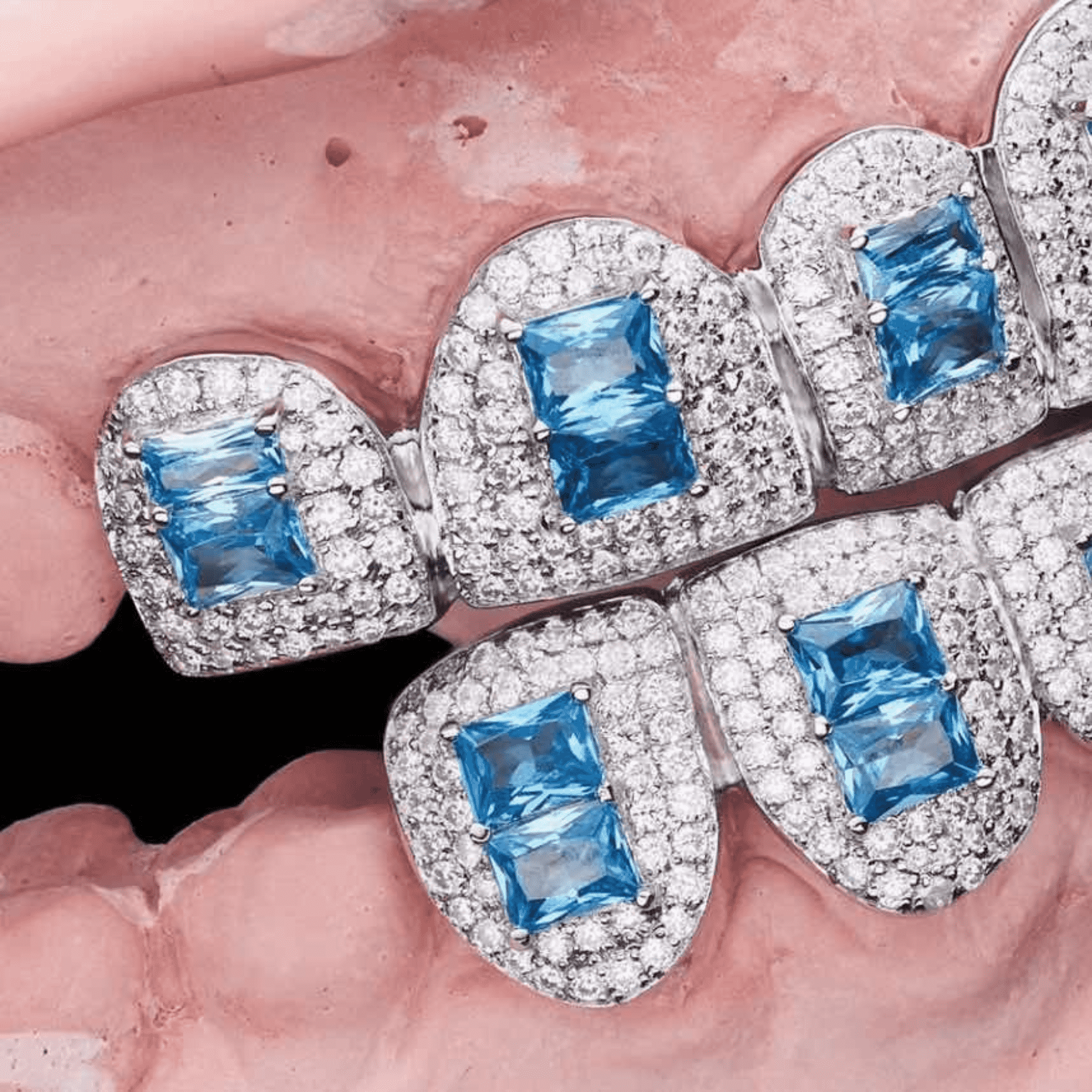 VVS Moissanite Designer Teeth Grillz – Handcrafted High Clarity Stones 3 VVS Moissanite Designer Teeth Grillz – Handcrafted High Clarity Stones - Image 3