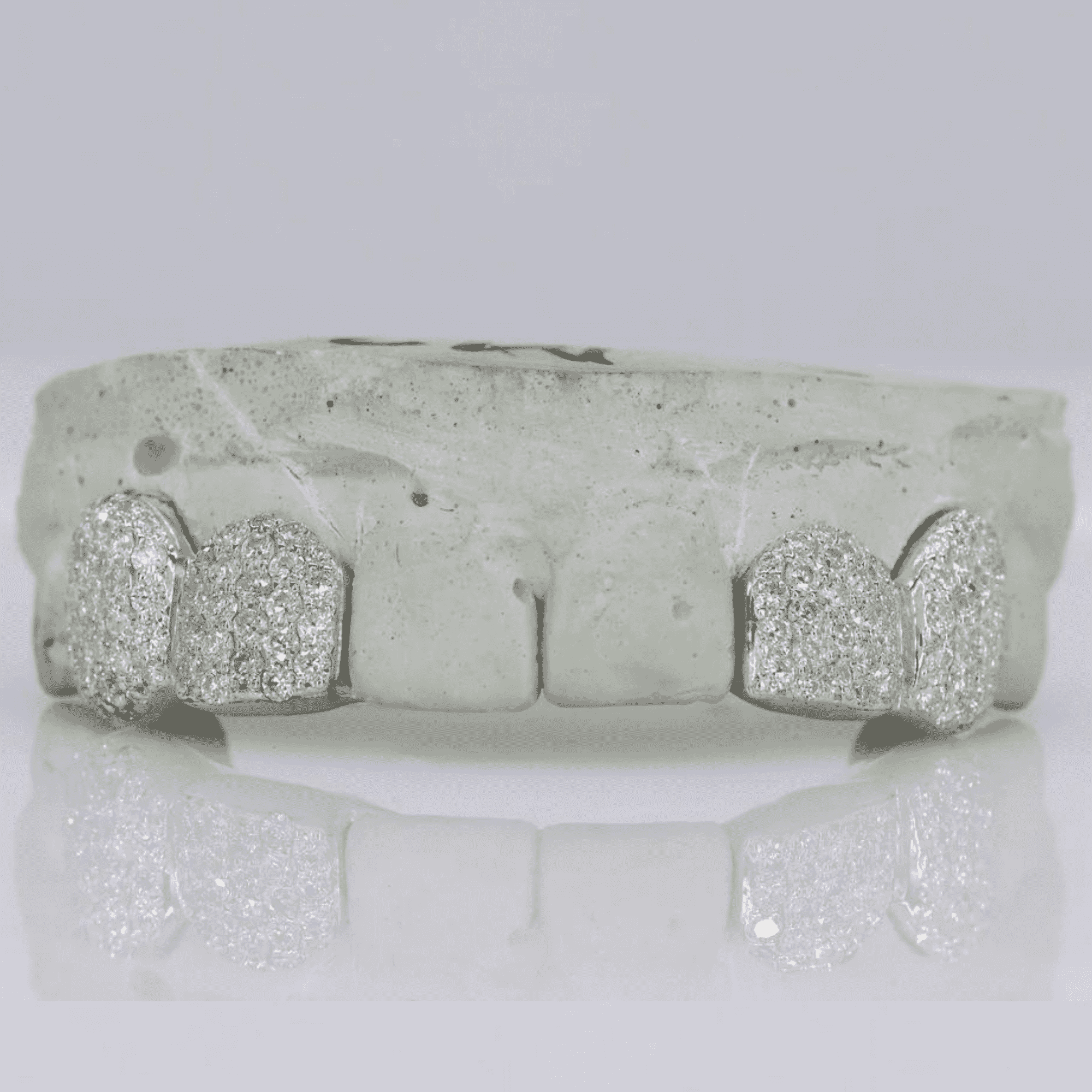 Iced Out Custom Mold Teeth Grillz Set – Maximum Shine with Perfect Fit 2 Iced Out Custom Mold Teeth Grillz Set – Maximum Shine with Perfect Fit - Image 2