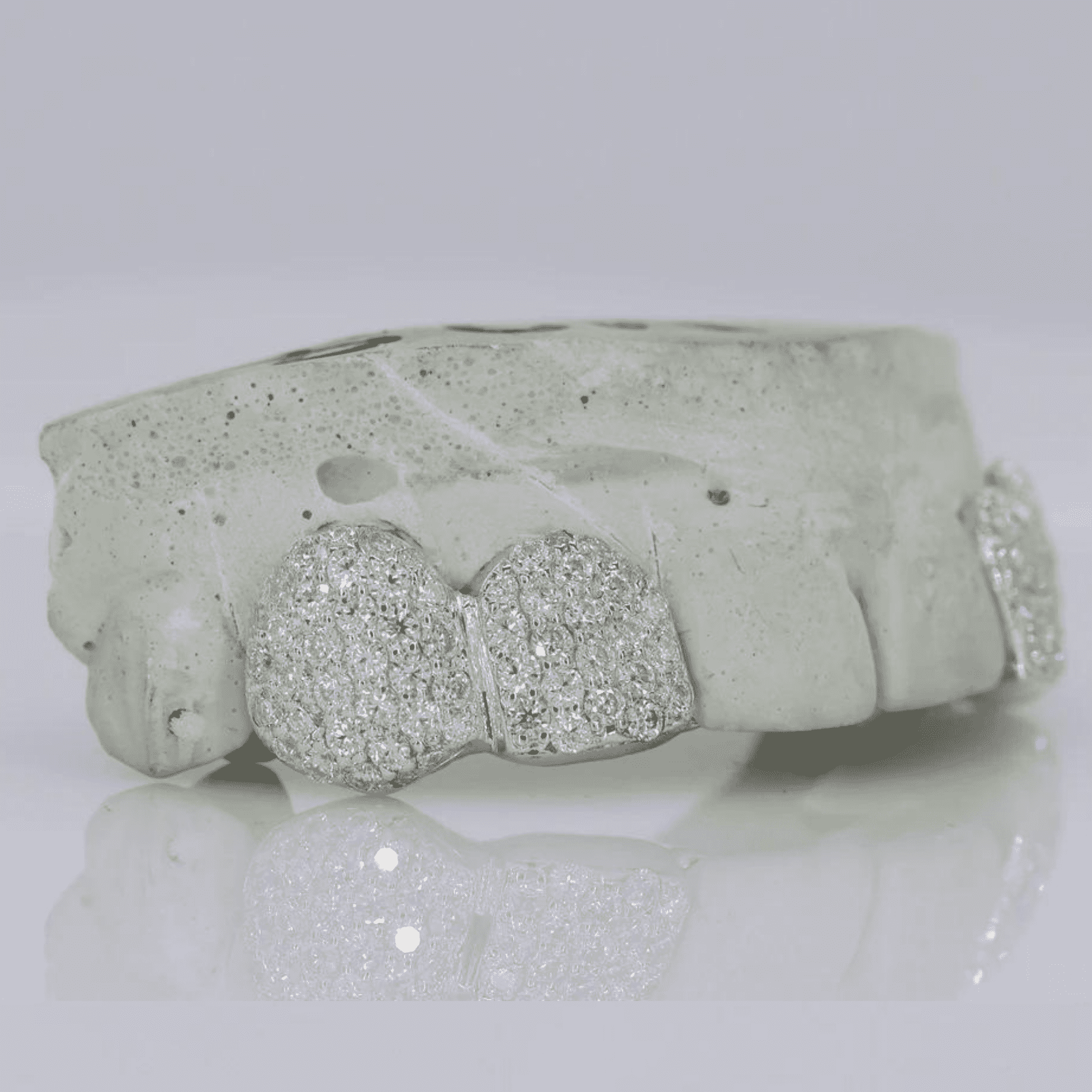 Iced Out Custom Mold Teeth Grillz Set – Maximum Shine with Perfect Fit 3 Iced Out Custom Mold Teeth Grillz Set – Maximum Shine with Perfect Fit - Image 3