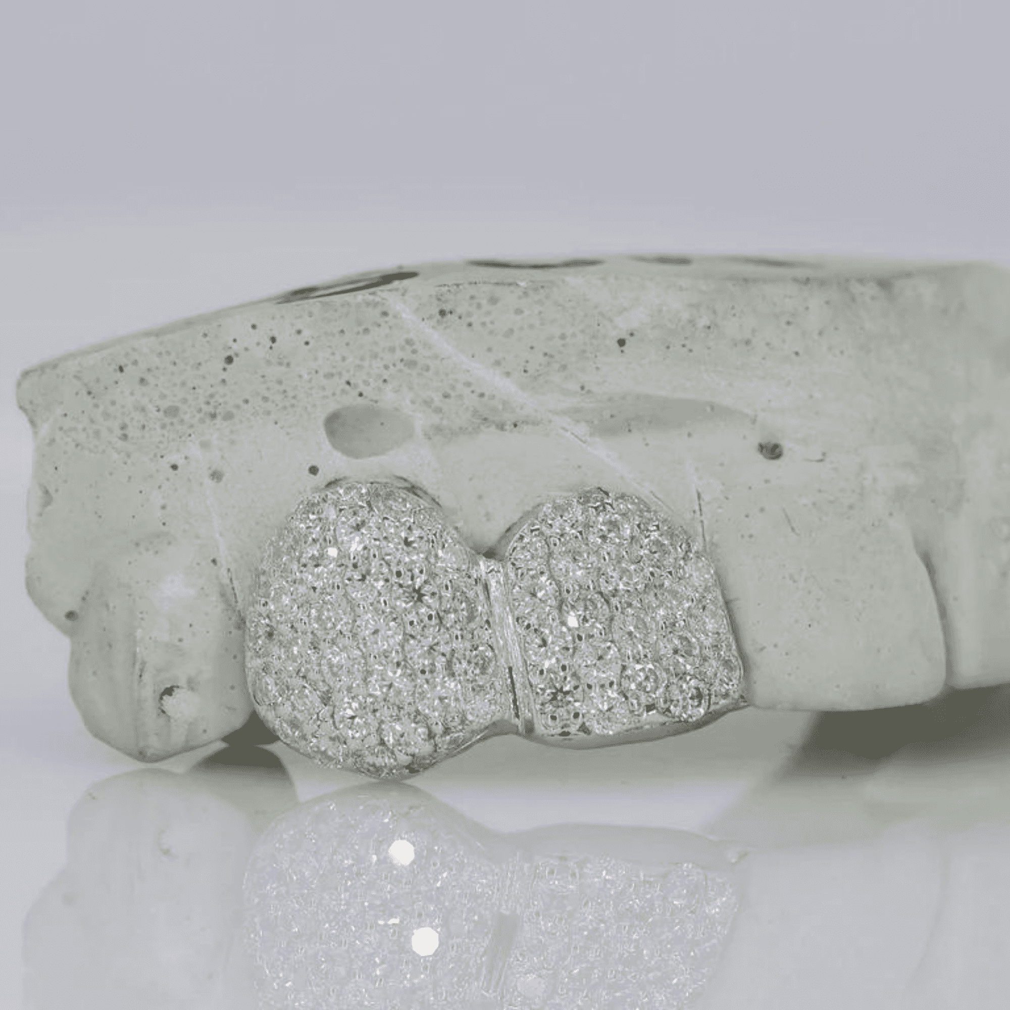 Iced Out Custom Mold Teeth Grillz Set – Maximum Shine with Perfect Fit 4 Iced Out Custom Mold Teeth Grillz Set – Maximum Shine with Perfect Fit - Image 4