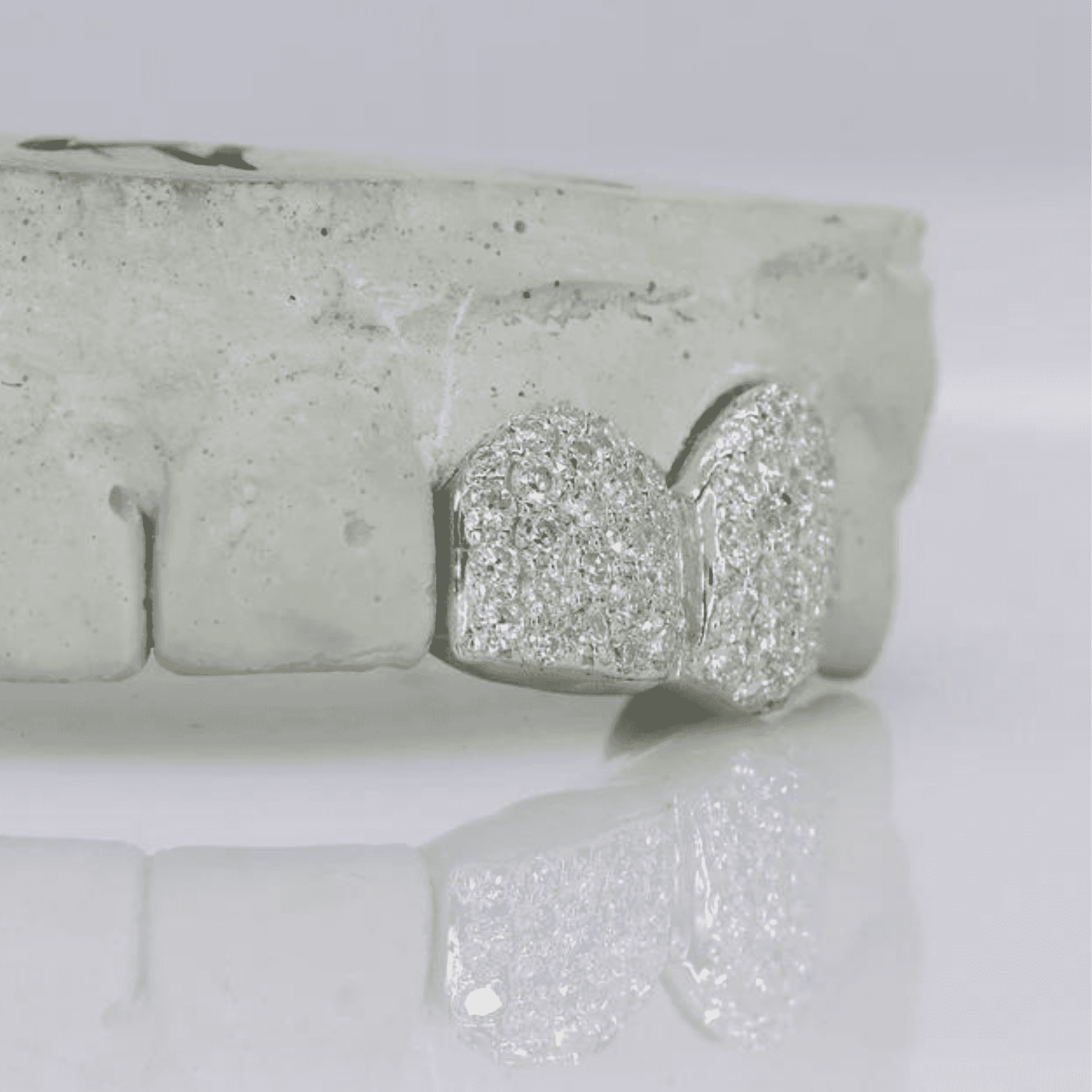 Iced Out Custom Mold Teeth Grillz Set – Maximum Shine with Perfect Fit 5 Iced Out Custom Mold Teeth Grillz Set – Maximum Shine with Perfect Fit - Image 5