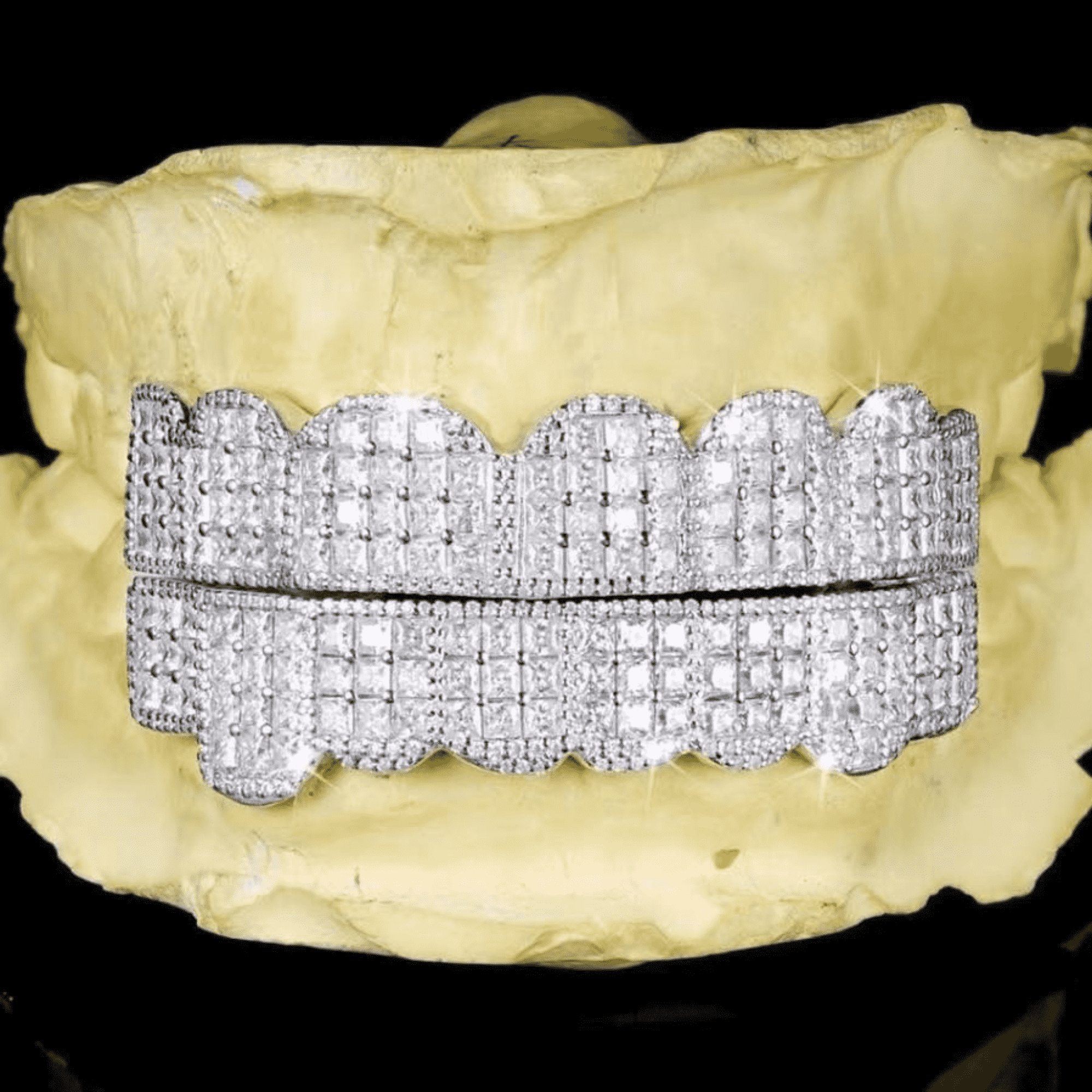 925 Silver Shine Teeth Grillz – Minimalist, Stylish & Strong Silver Teeth Grills - Image 3