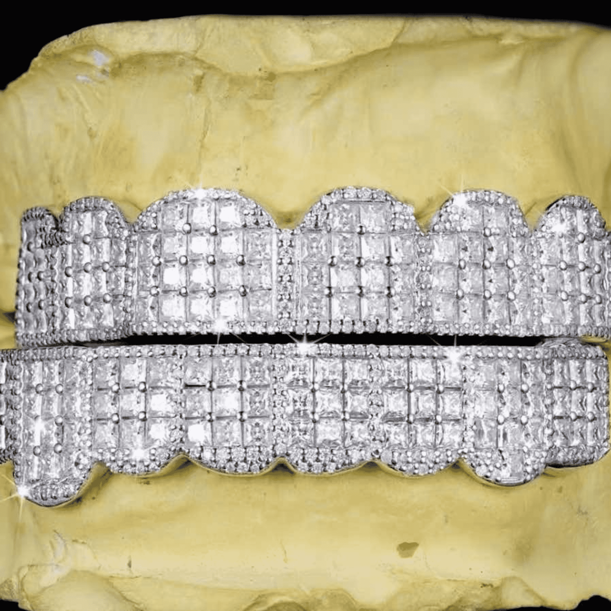 925 Silver Shine Teeth Grillz – Minimalist, Stylish & Strong Silver Teeth Grills - Image 4