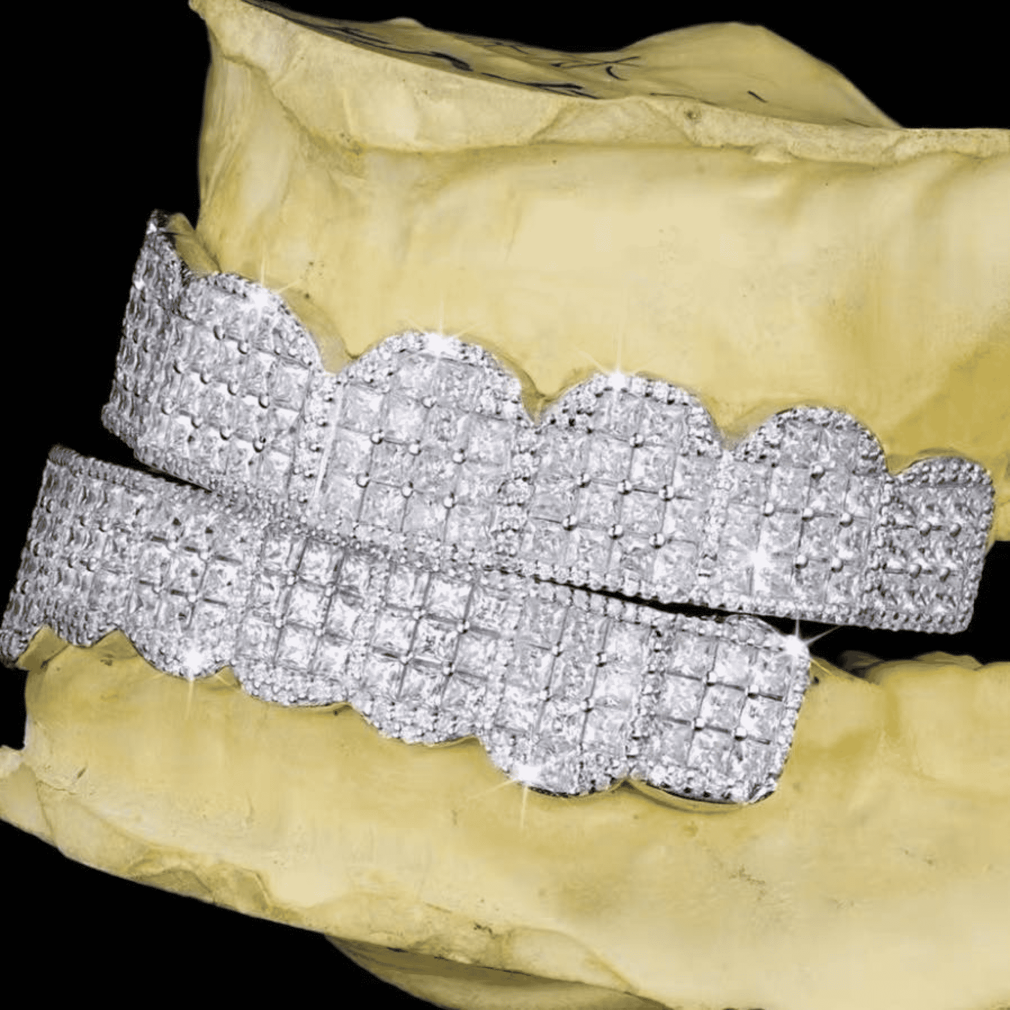 925 Silver Shine Teeth Grillz – Minimalist, Stylish & Strong Silver Teeth Grills - Image 5