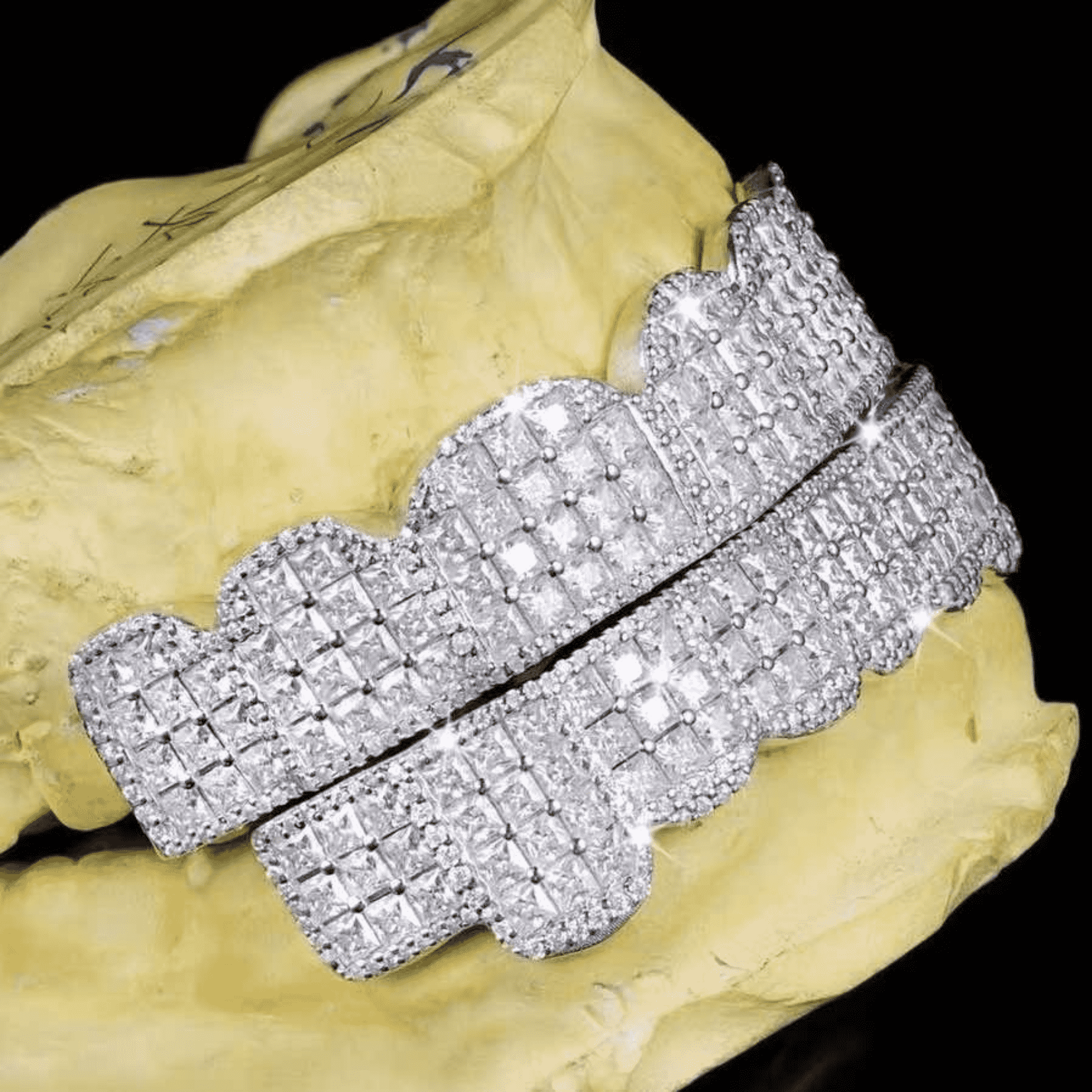 925 Silver Shine Teeth Grillz – Minimalist, Stylish & Strong Silver Teeth Grills - Image 6