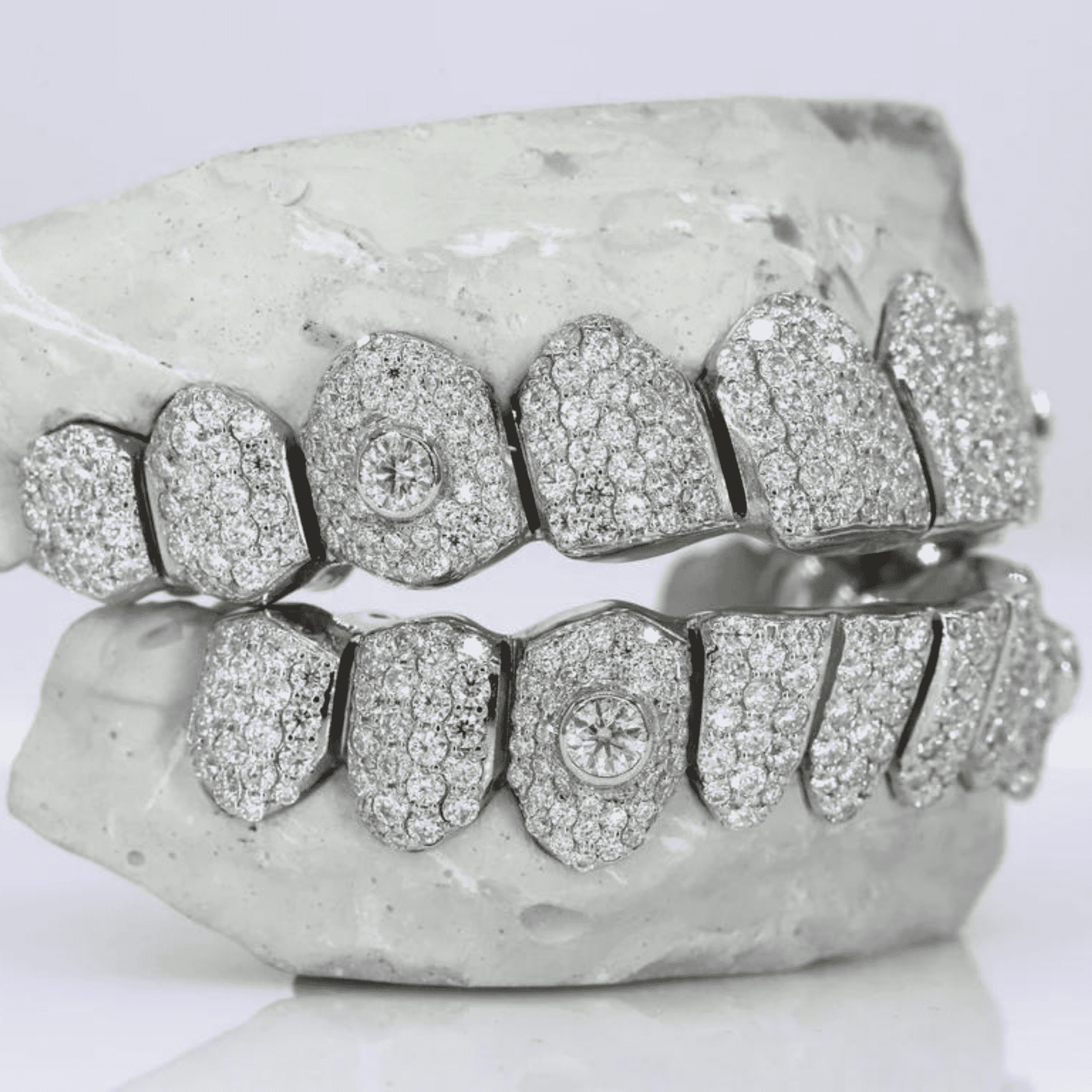 Luxury 18K Gold Hip-Hop Teeth Grillz – Deep Gold Color & Premium Finish 3 Luxury 18K Gold Hip-Hop Teeth Grillz – Deep Gold Color & Premium Finish - Image 3