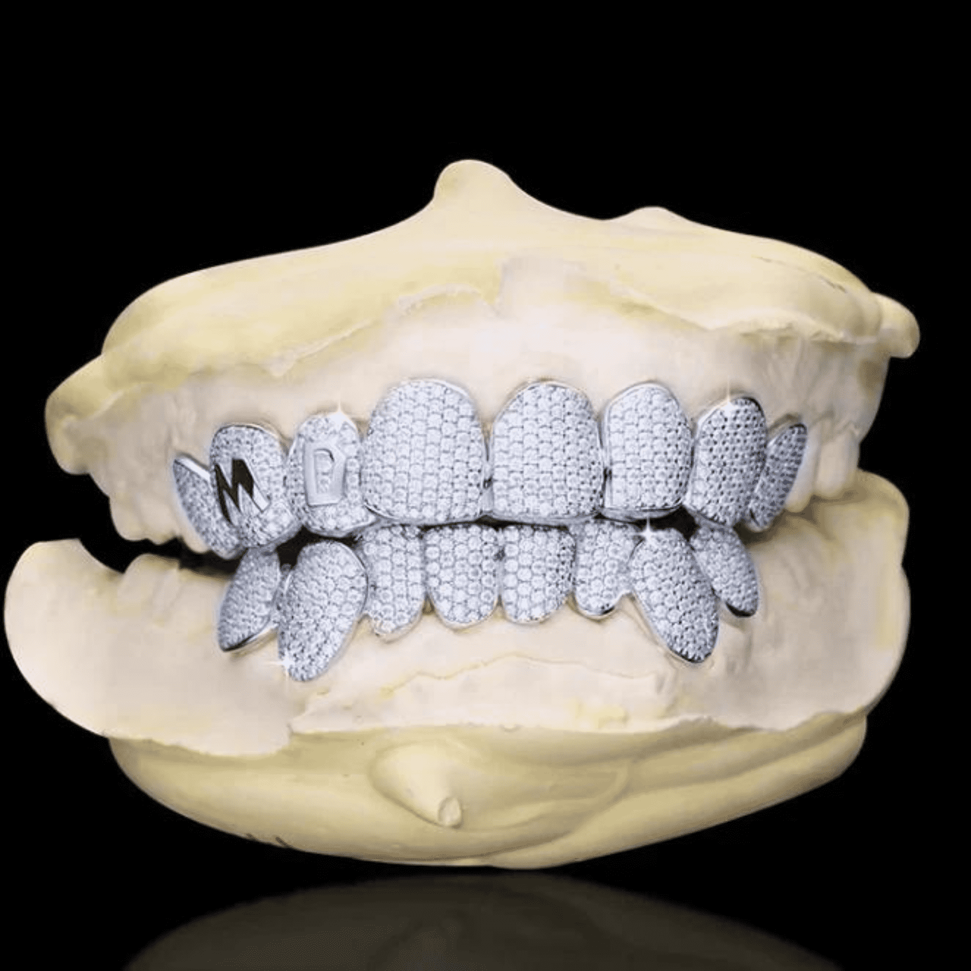 Premium Moissanite Diamond Teeth Grillz – High Sparkle Luxury Finish 3 Premium Moissanite Diamond Teeth Grillz – High Sparkle Luxury Finish - Image 3