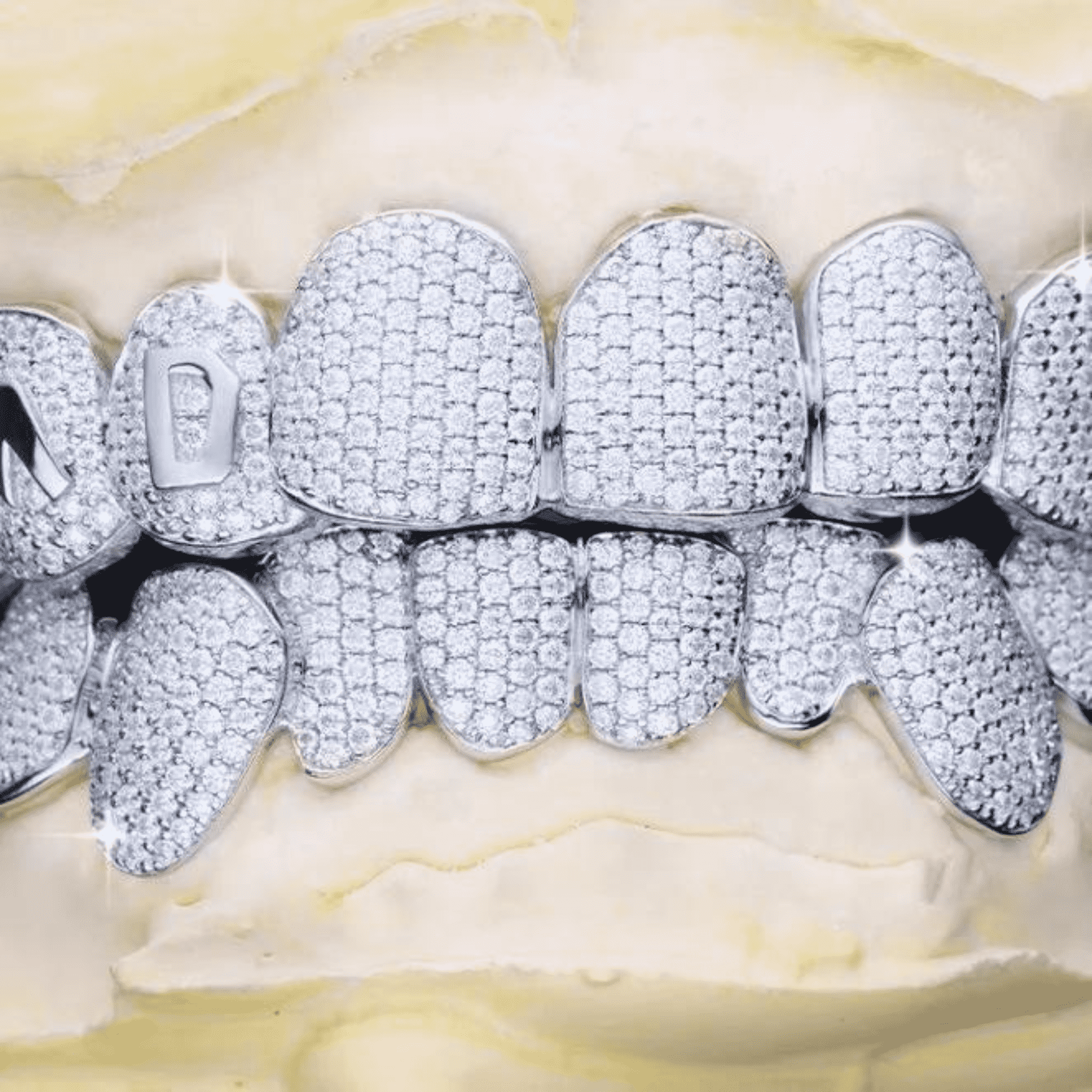 Premium Moissanite Diamond Teeth Grillz – High Sparkle Luxury Finish 6 Premium Moissanite Diamond Teeth Grillz – High Sparkle Luxury Finish - Image 6