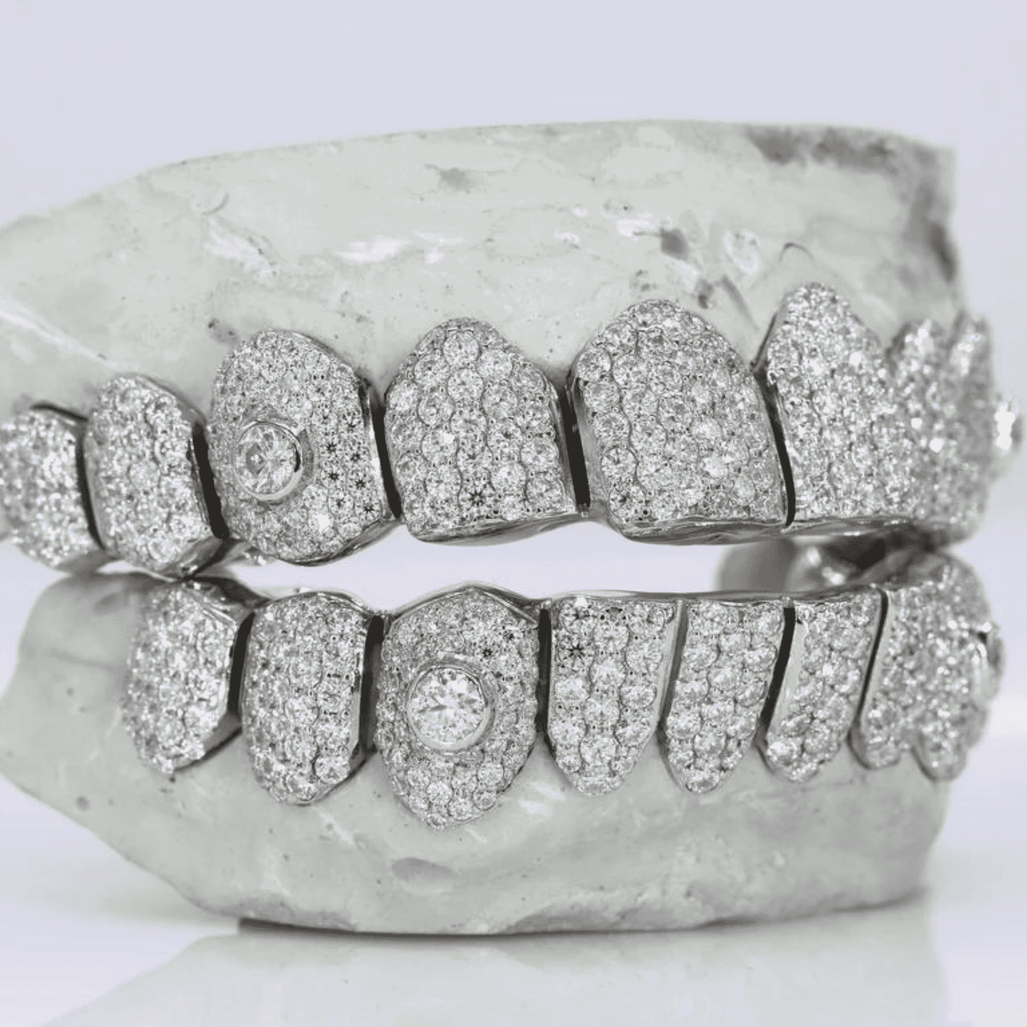 Luxury 18K Gold Hip-Hop Teeth Grillz – Deep Gold Color & Premium Finish 4 Luxury 18K Gold Hip-Hop Teeth Grillz – Deep Gold Color & Premium Finish - Image 4