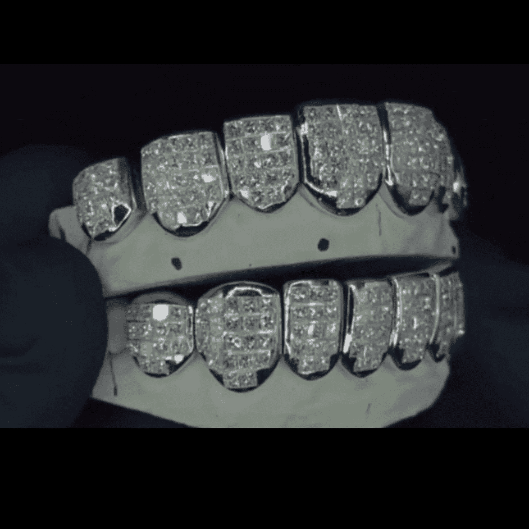 High-End VVS Moissanite Iced Grillz – Realistic Diamond Fire Shine 3 High-End VVS Moissanite Iced Grillz – Realistic Diamond Fire Shine - Image 3