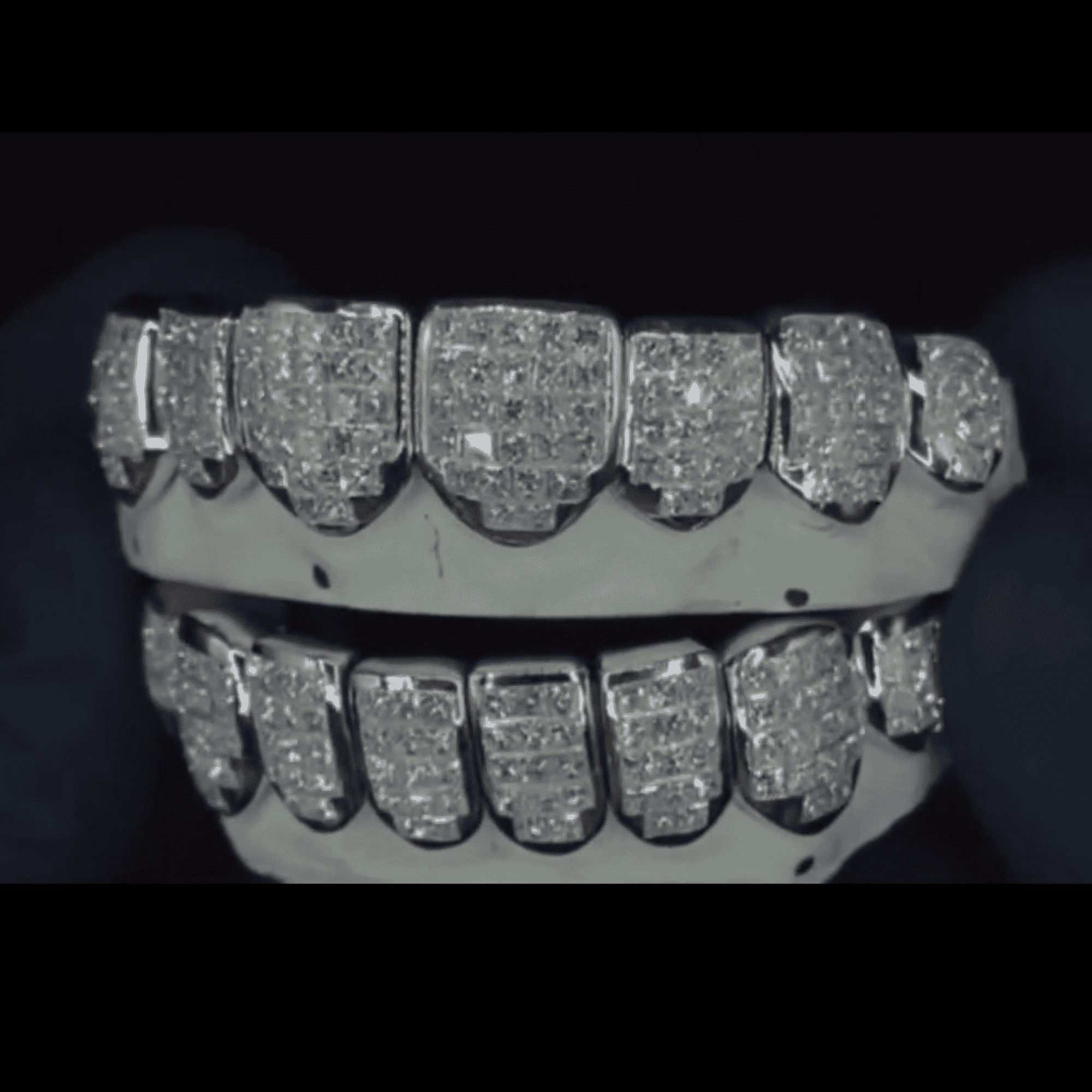 High-End VVS Moissanite Iced Grillz – Realistic Diamond Fire Shine 4 High-End VVS Moissanite Iced Grillz – Realistic Diamond Fire Shine - Image 4