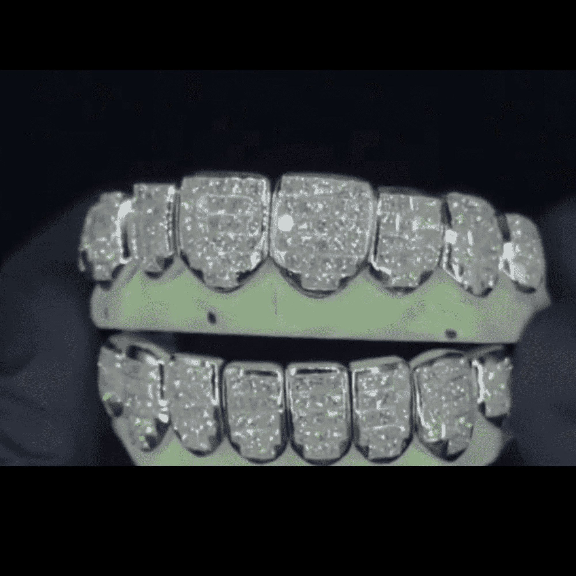 High-End VVS Moissanite Iced Grillz – Realistic Diamond Fire Shine 5 High-End VVS Moissanite Iced Grillz – Realistic Diamond Fire Shine - Image 5