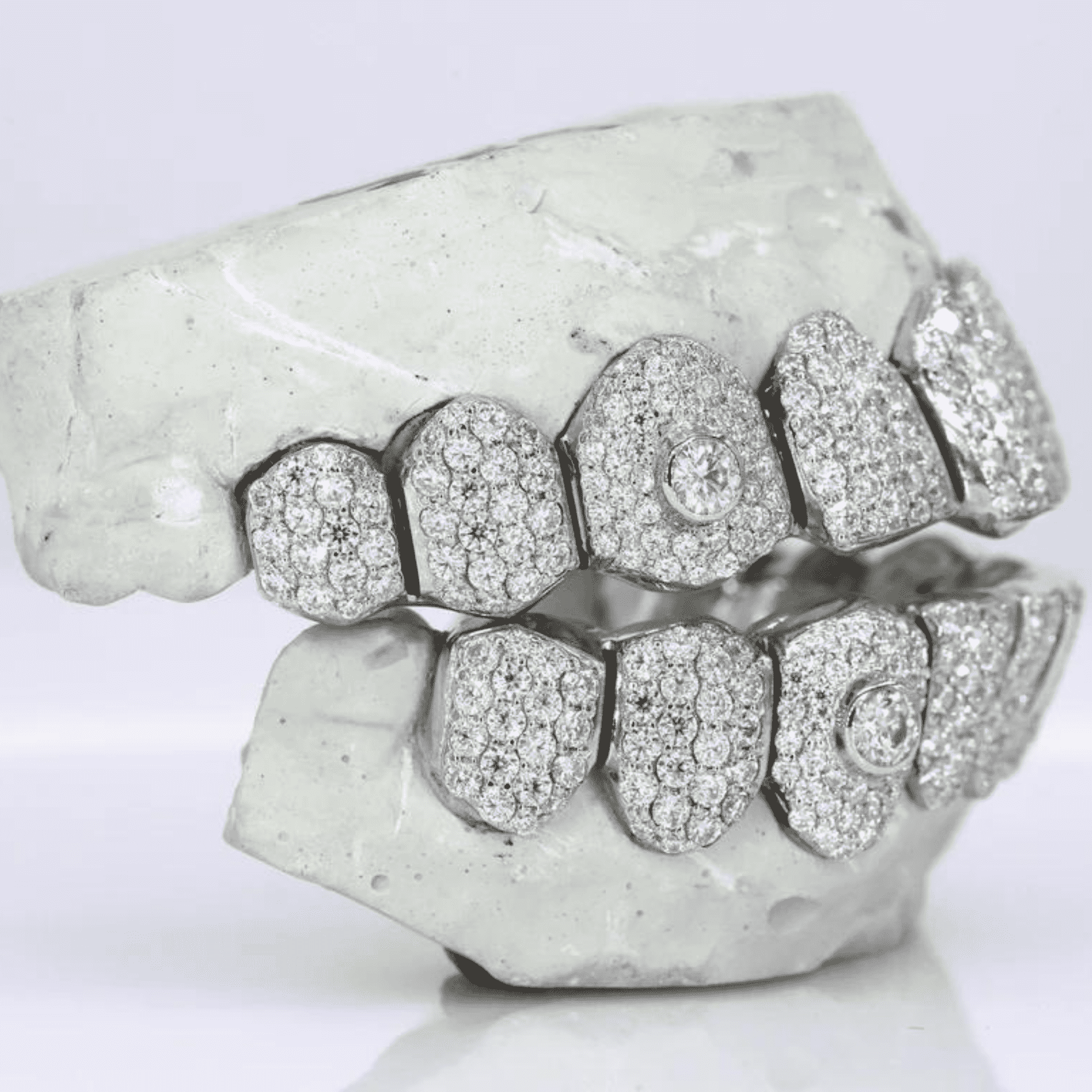 Luxury 18K Gold Hip-Hop Teeth Grillz – Deep Gold Color & Premium Finish 5 Luxury 18K Gold Hip-Hop Teeth Grillz – Deep Gold Color & Premium Finish - Image 5