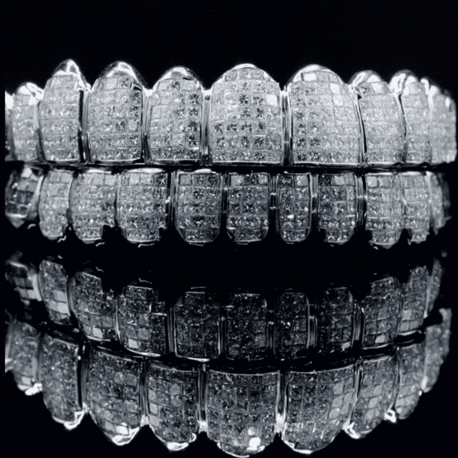 Fully Iced Luxury Teeth Grillz – High Fashion Hip-Hop Bling Accessory