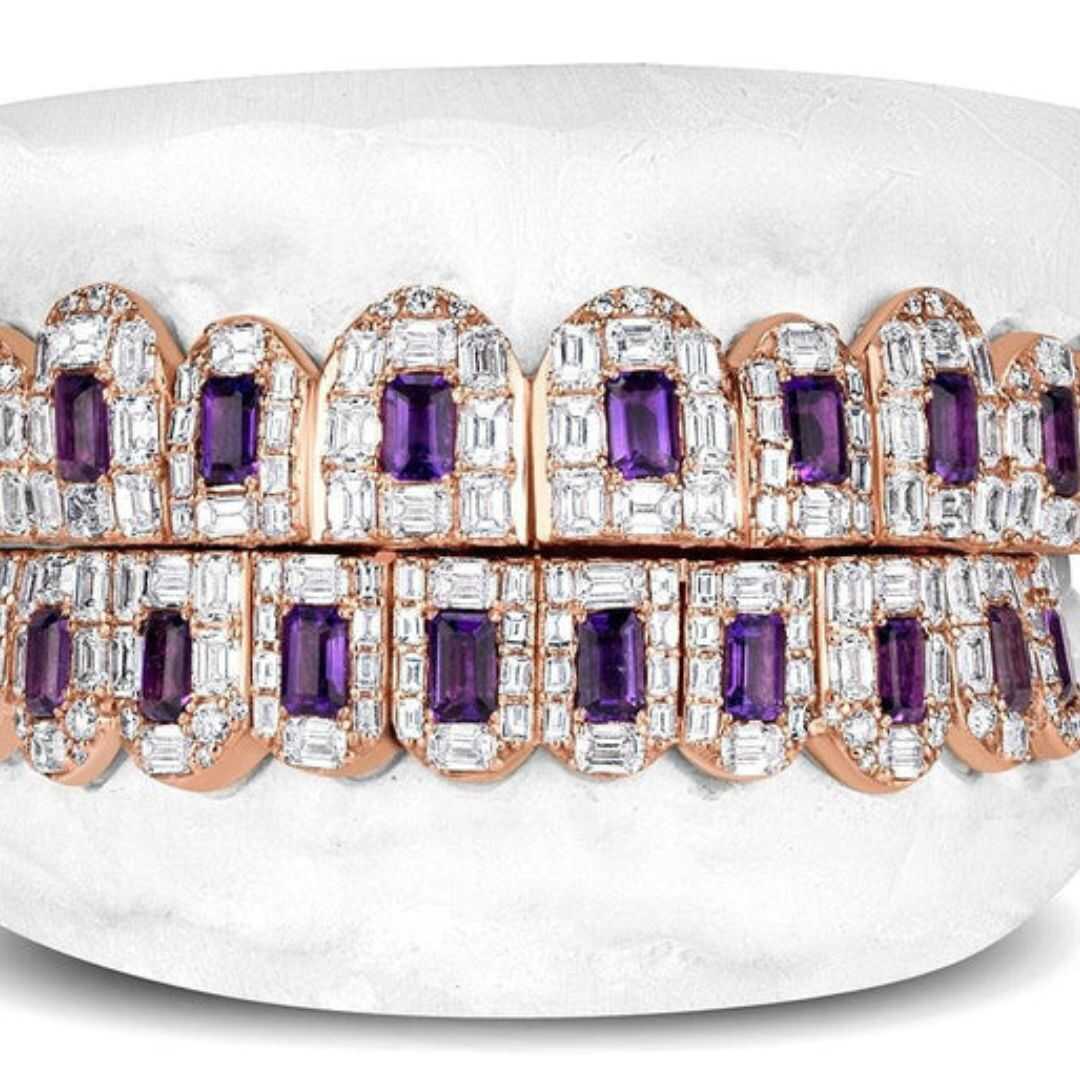 Gold Vibe Luxury Teeth Grillz – Smooth, Stylish & Durable Gold Plating 2 Si Diamond Grillz