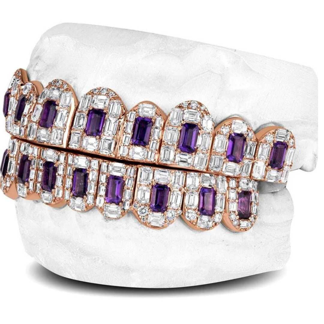 Gold Vibe Luxury Teeth Grillz – Smooth, Stylish & Durable Gold Plating 1 Si Diamond Grillz
