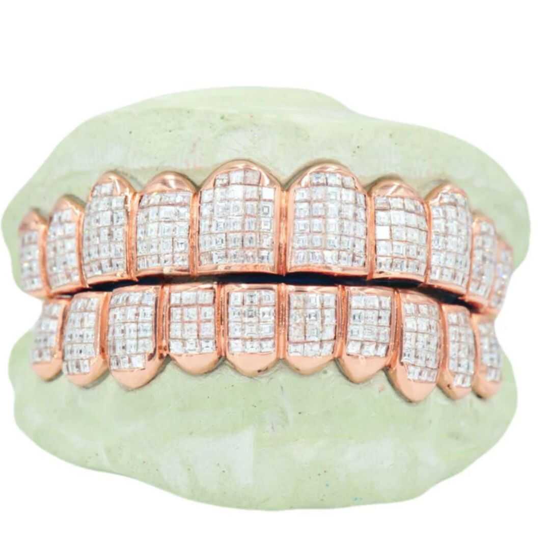 Moissanite Radiant Cut Teeth Grillz – High-End Shine & Realistic Spark 2 Diamond Grillz On Teeth