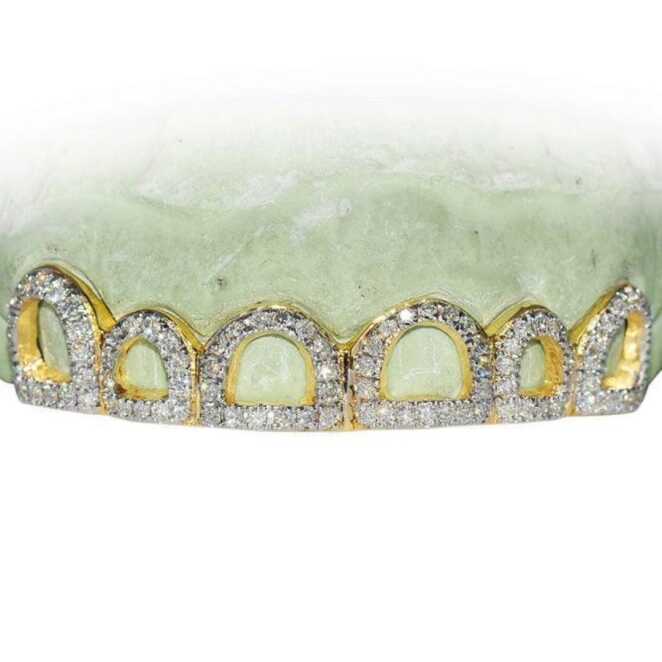 Diamond Grillz on Teeth
