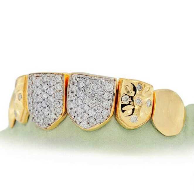 Diamond Grillz on Teeth