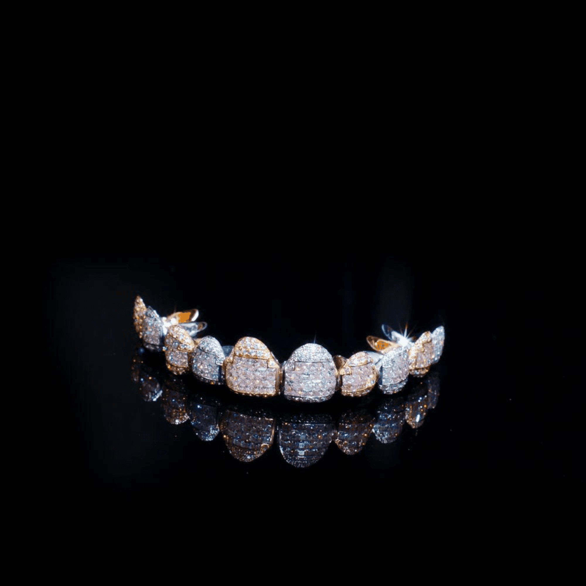 Heavy Iced Out Luxury Teeth Grillz Shine Beyond Expectations - Image 5