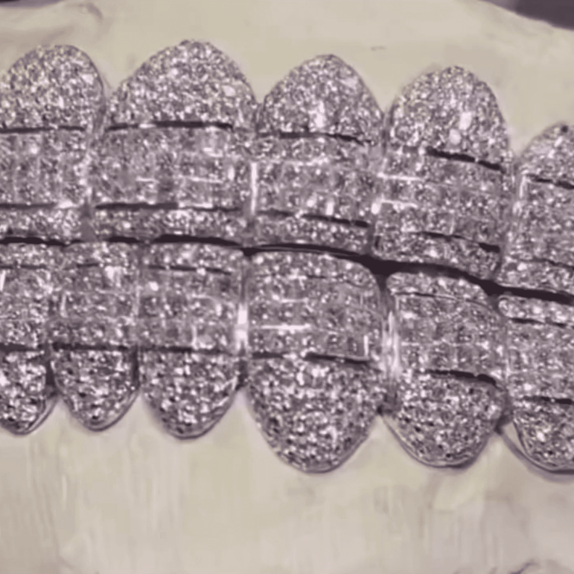 Double Row Iced Out Teeth Grillz – Maximum Shine Custom Fit Mouthpiece - Image 4