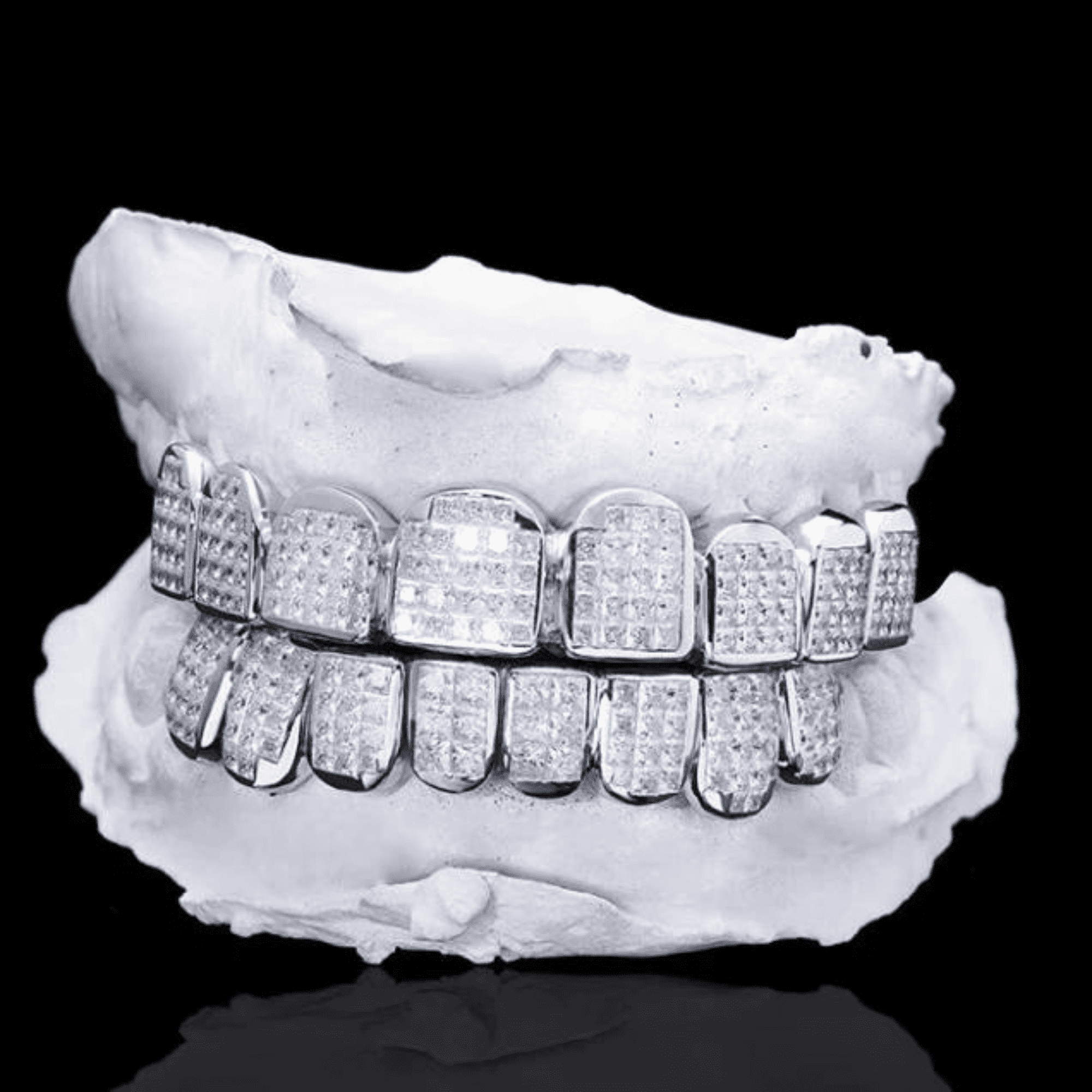 Luxury Moissanite Iced Out Teeth Grillz – Enhanced Sparkle & Clarity Finish