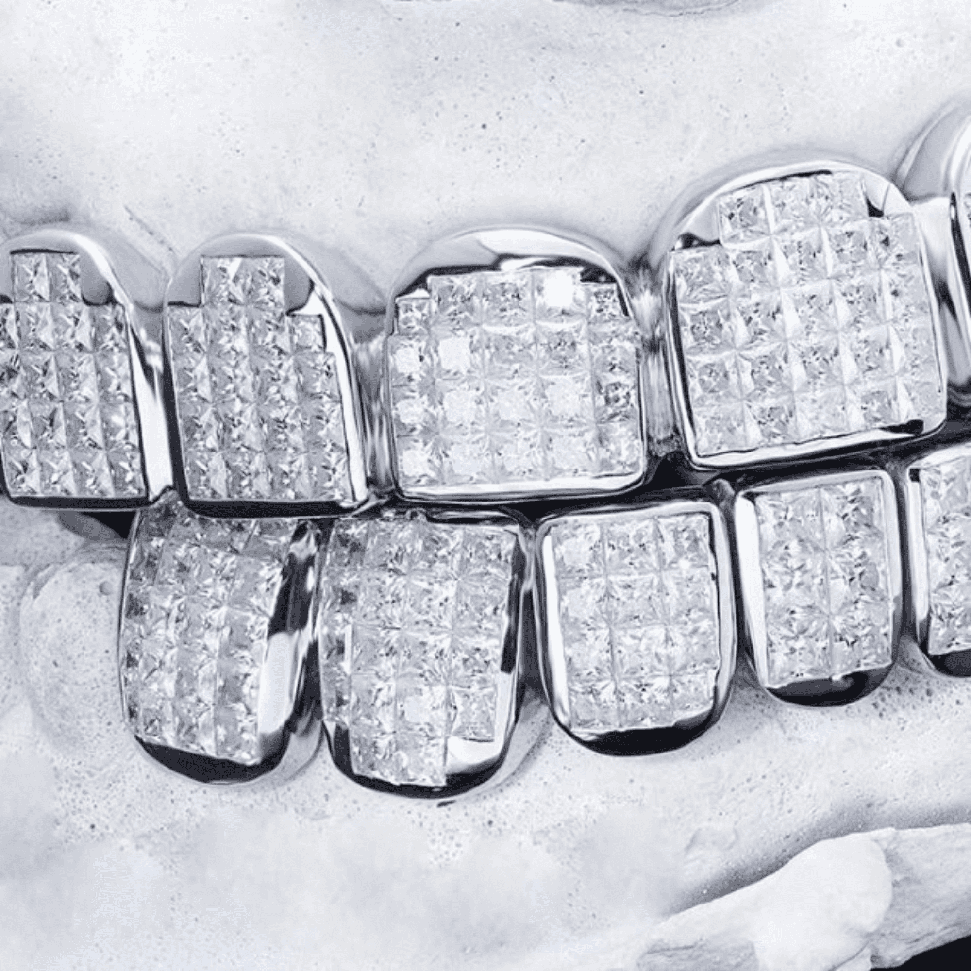 Luxury Moissanite Iced Out Teeth Grillz – Enhanced Sparkle & Clarity Finish - Image 3