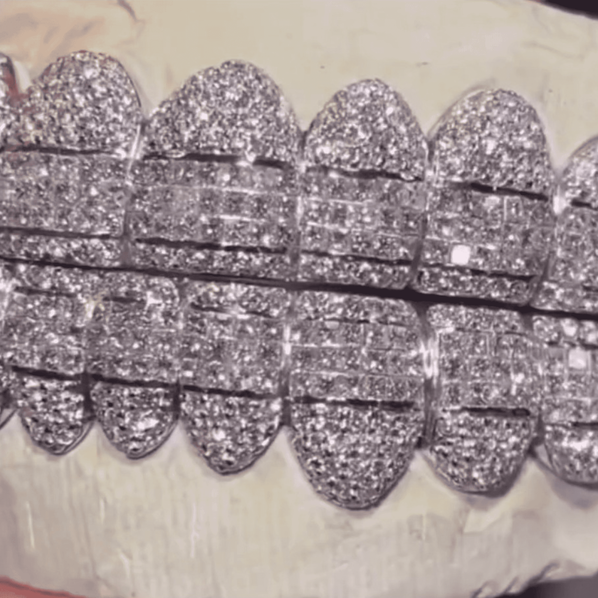 Double Row Iced Out Teeth Grillz – Maximum Shine Custom Fit Mouthpiece - Image 6